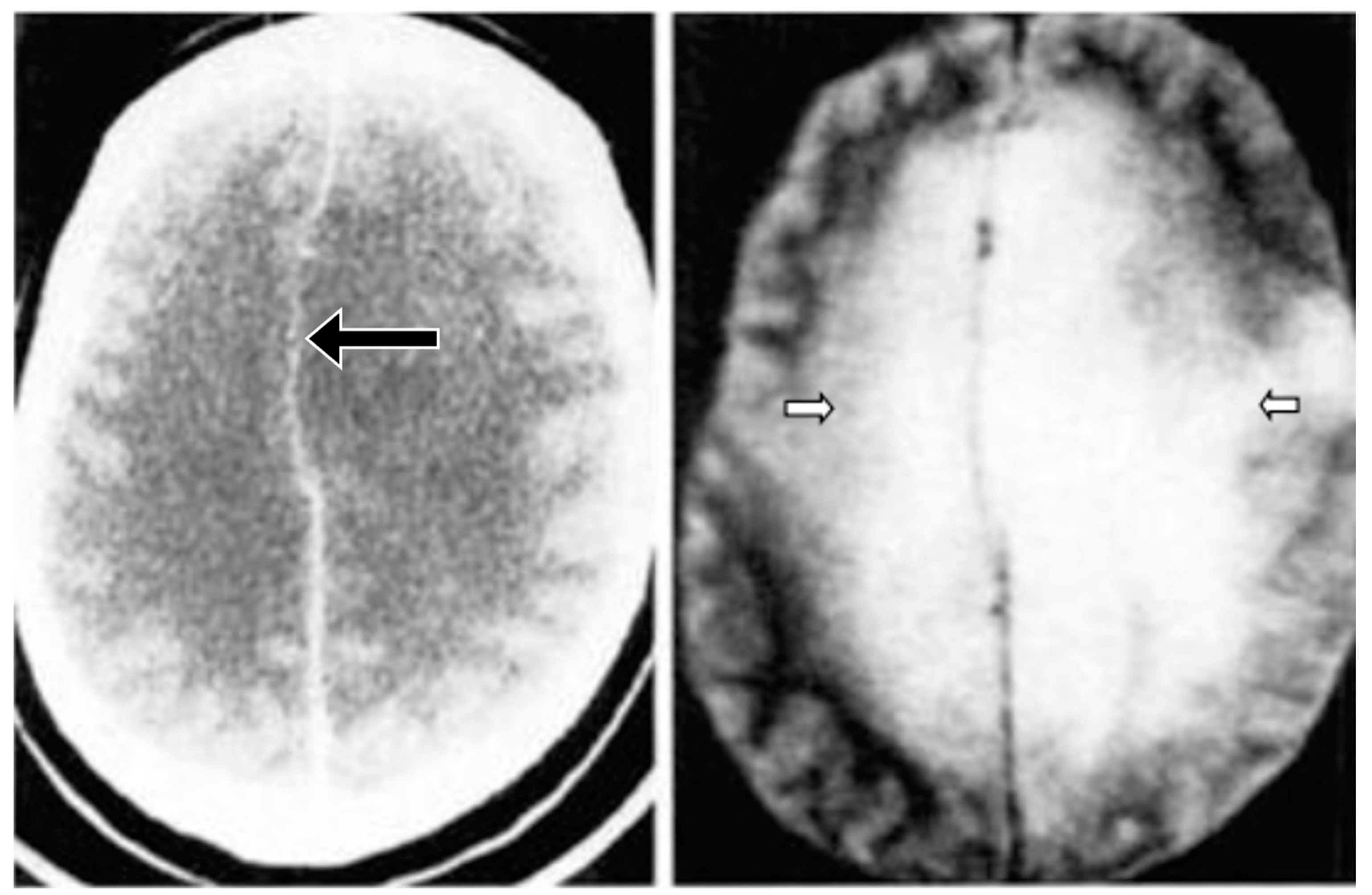 Tomography 10 00074 g009