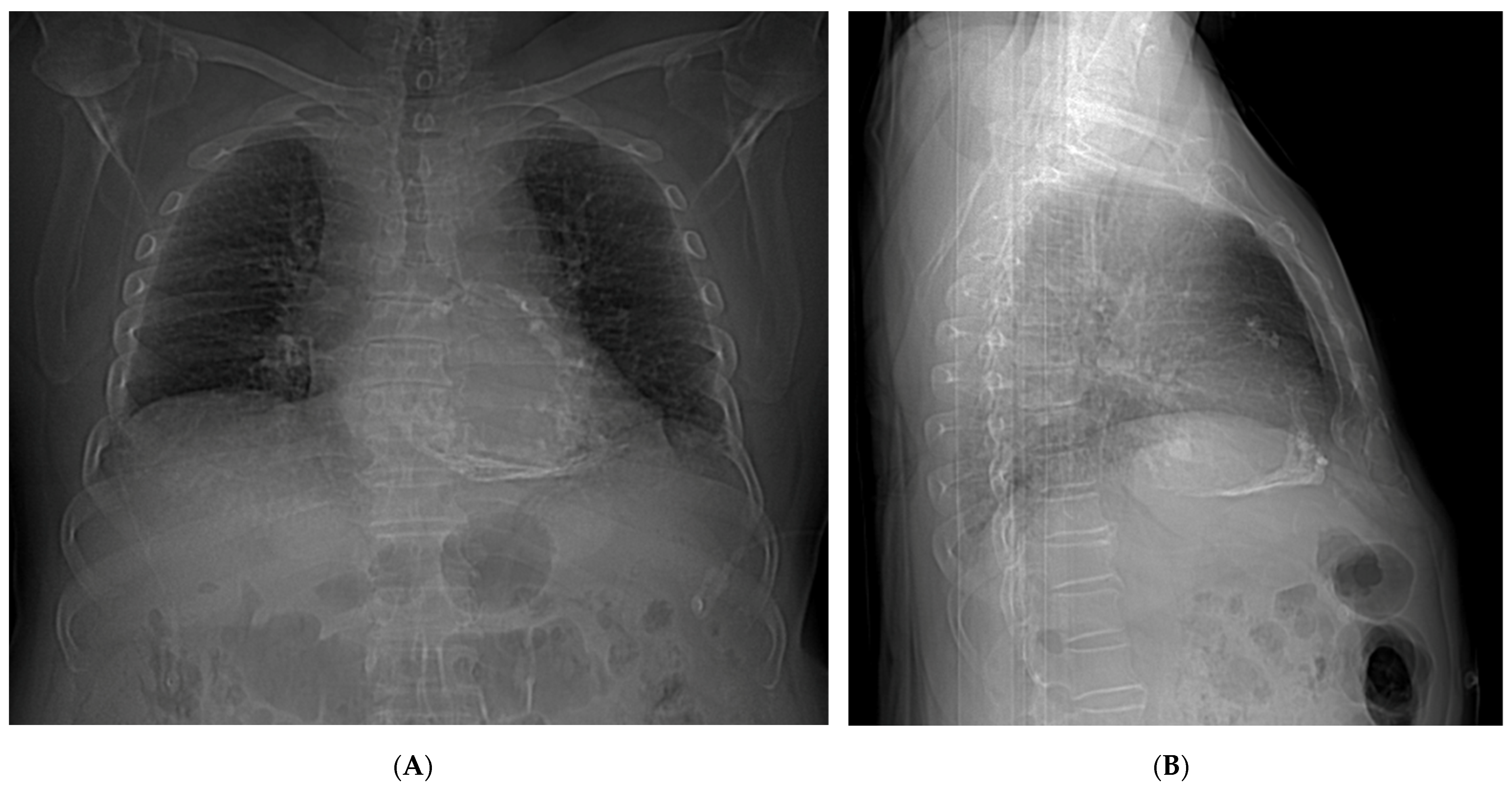 Tomography 10 00076 g001 Tomography 10 00076 g001