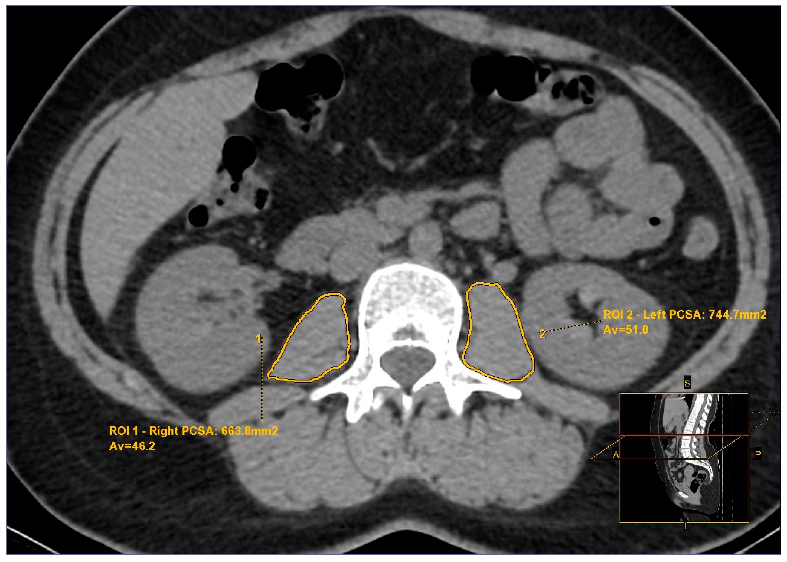 Tomography 10 00079 g001