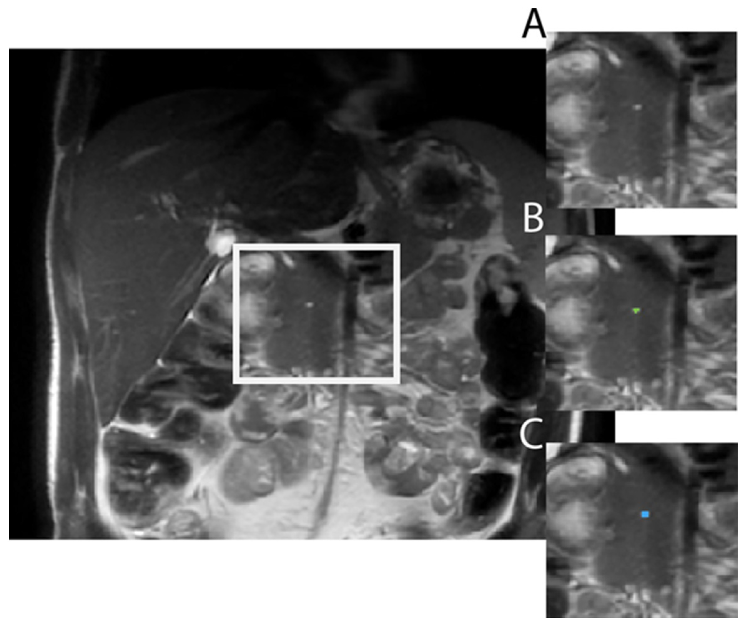 Tomography 10 00087 g001 Tomography 10 00087 g001