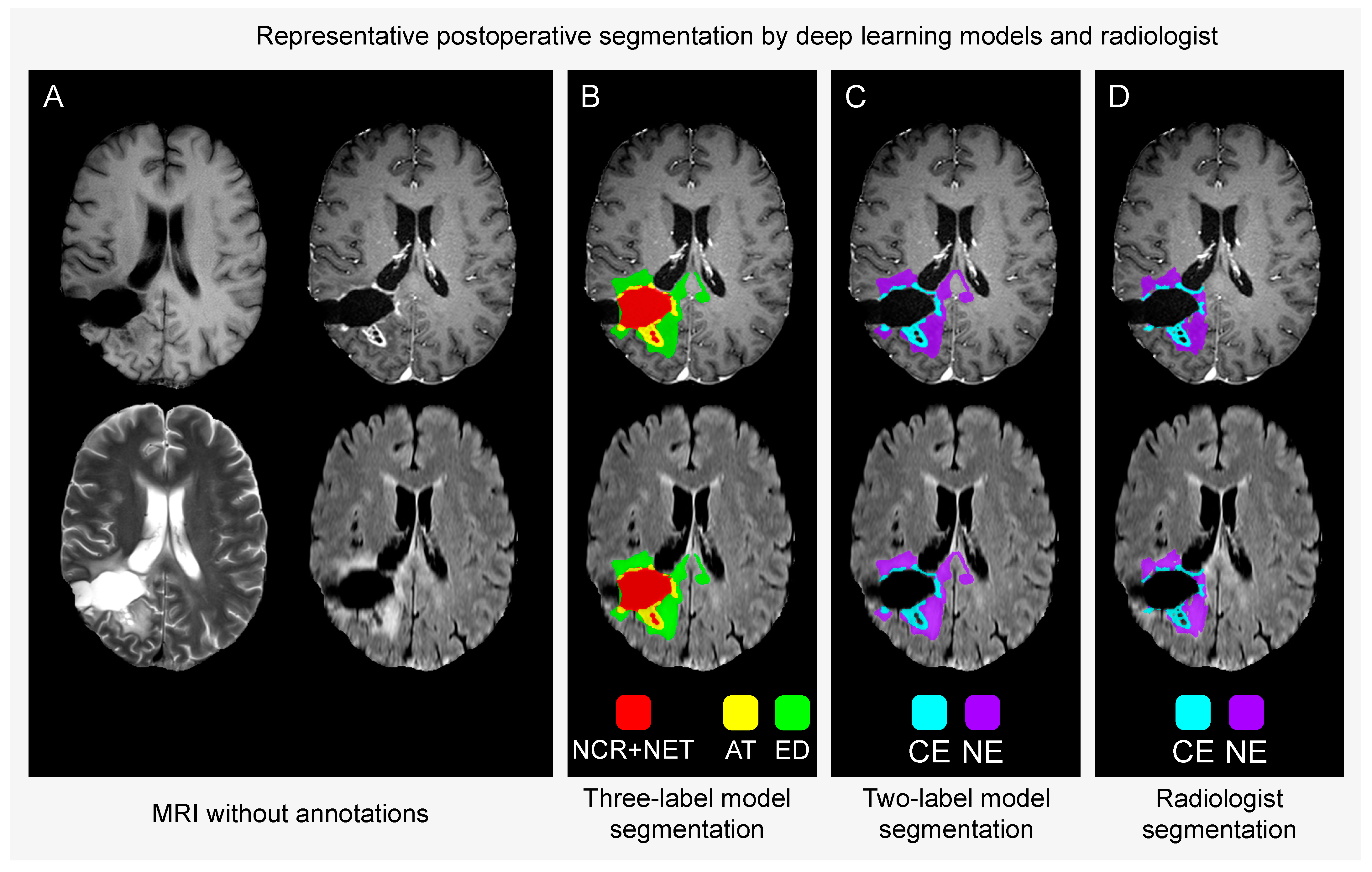 Tomography 10 00105 g002