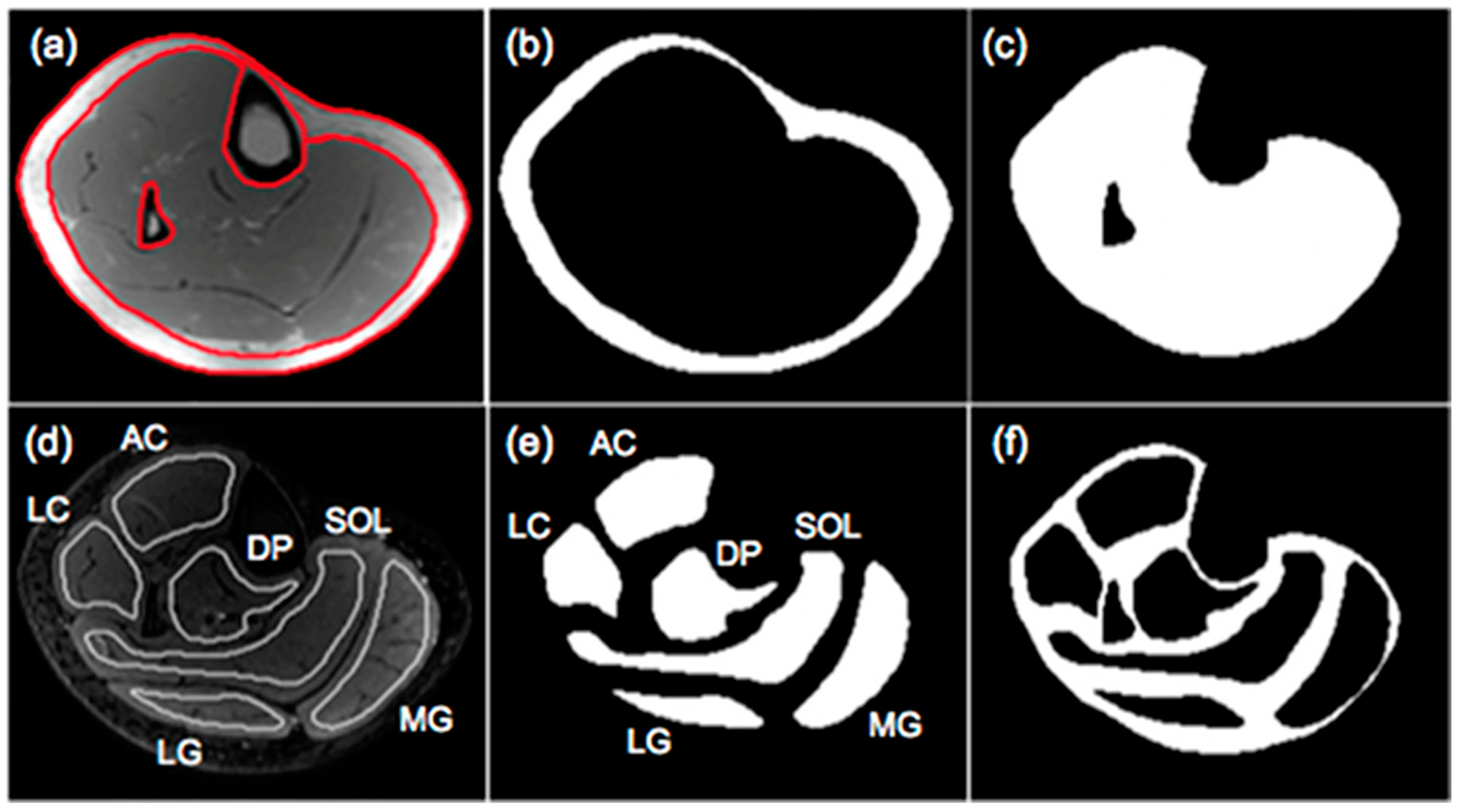 Tomography 10 00106 g002 Tomography 10 00106 g002