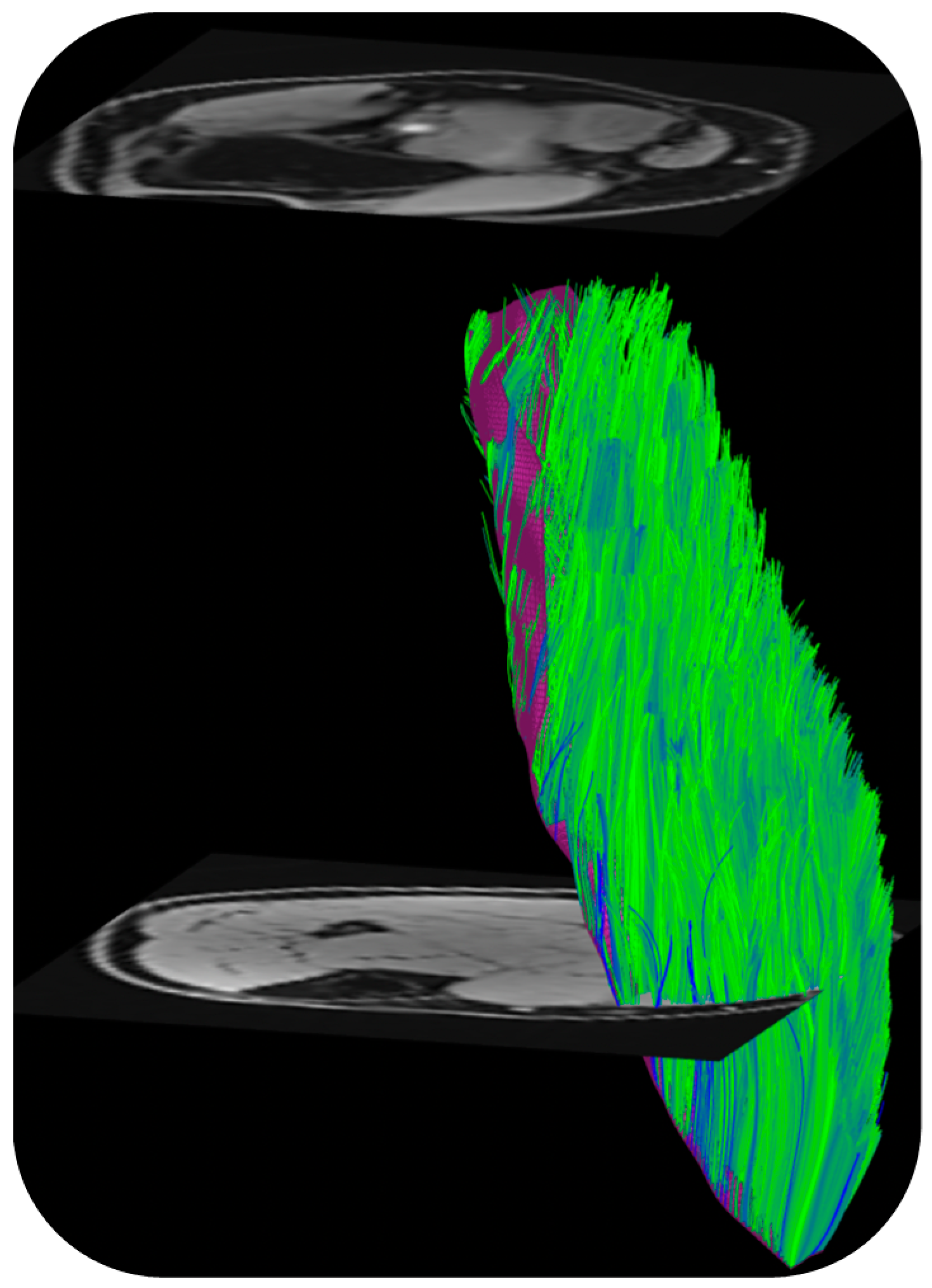 Tomography 10 00106 g003 Tomography 10 00106 g003
