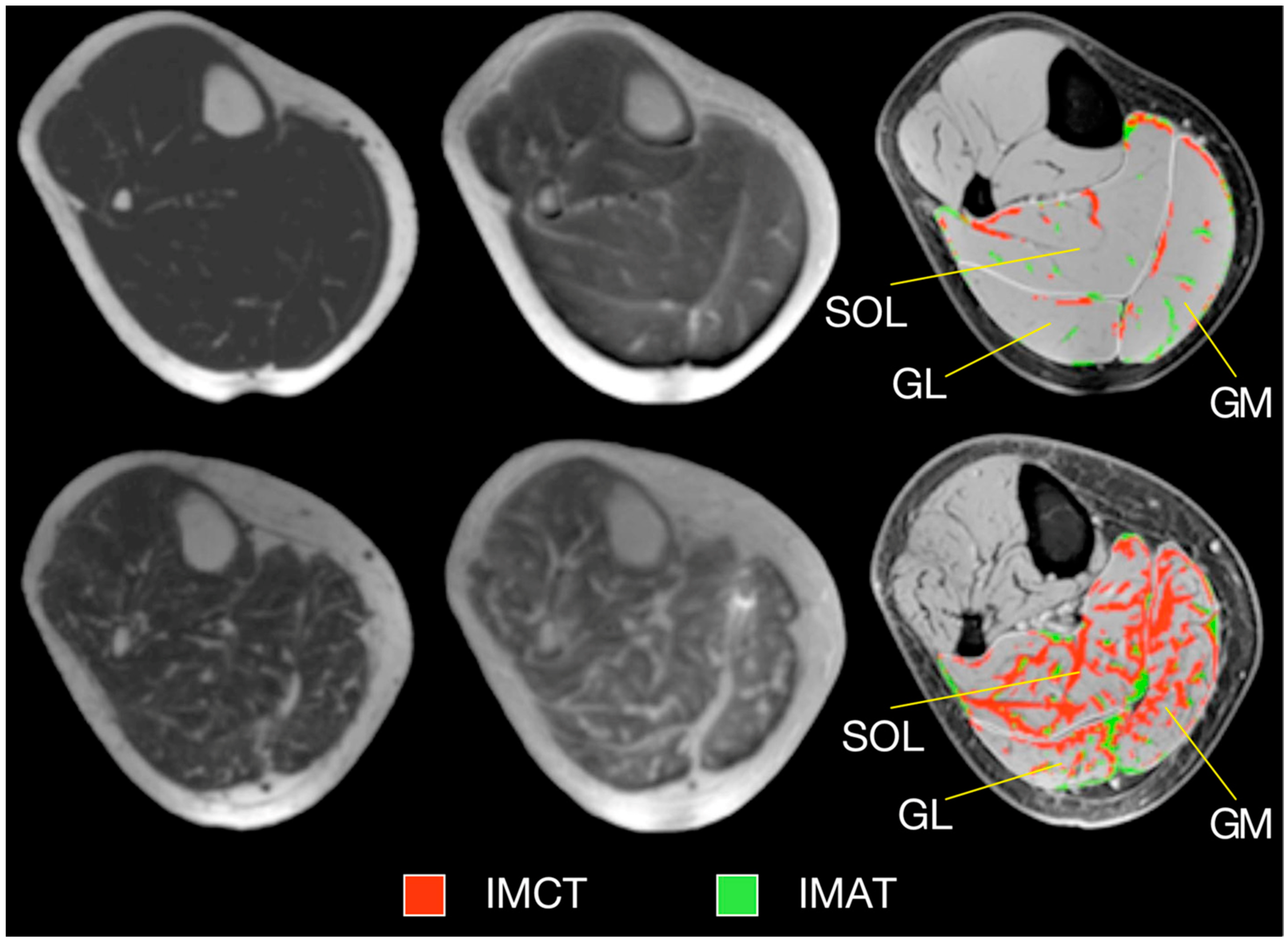Tomography 10 00106 g005 Tomography 10 00106 g005