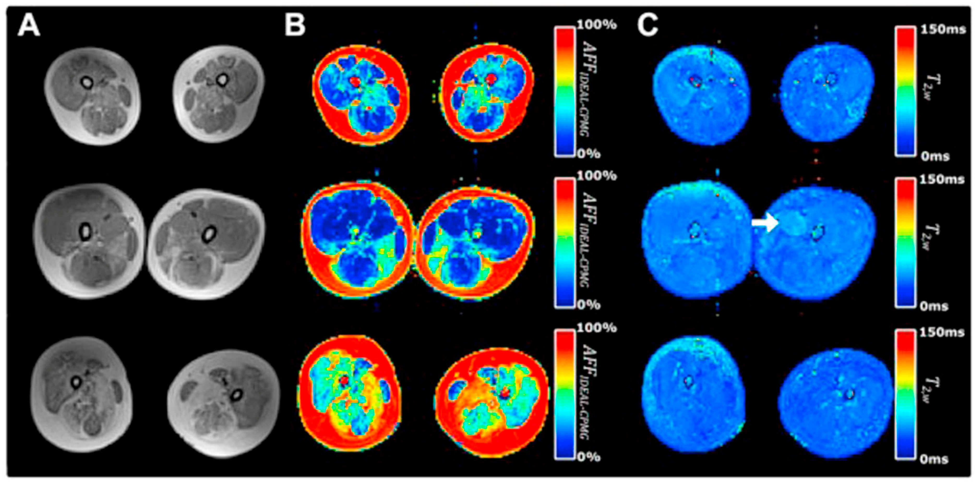 Tomography 10 00106 g007 Tomography 10 00106 g007