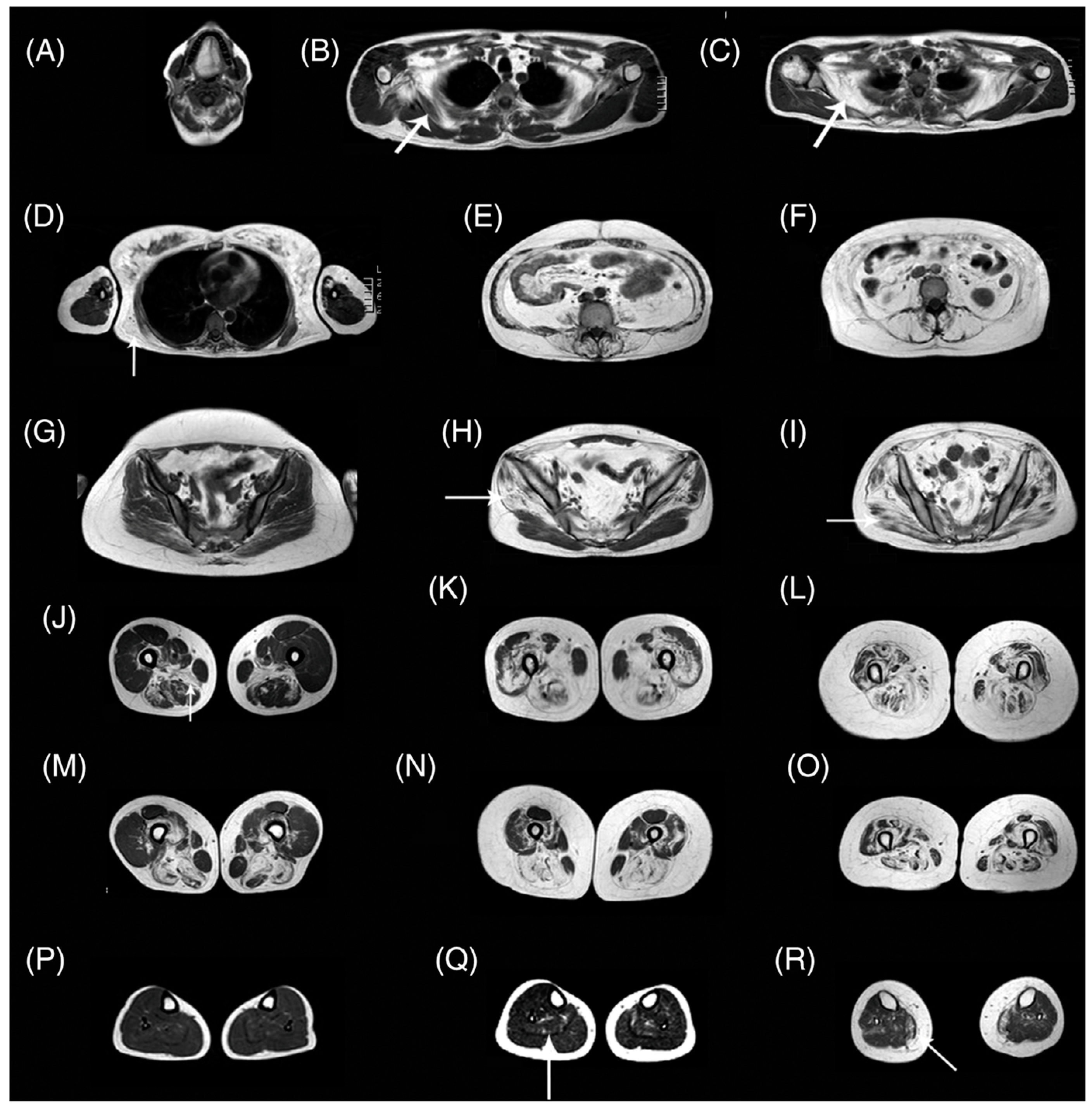 Tomography 10 00106 g008 Tomography 10 00106 g008