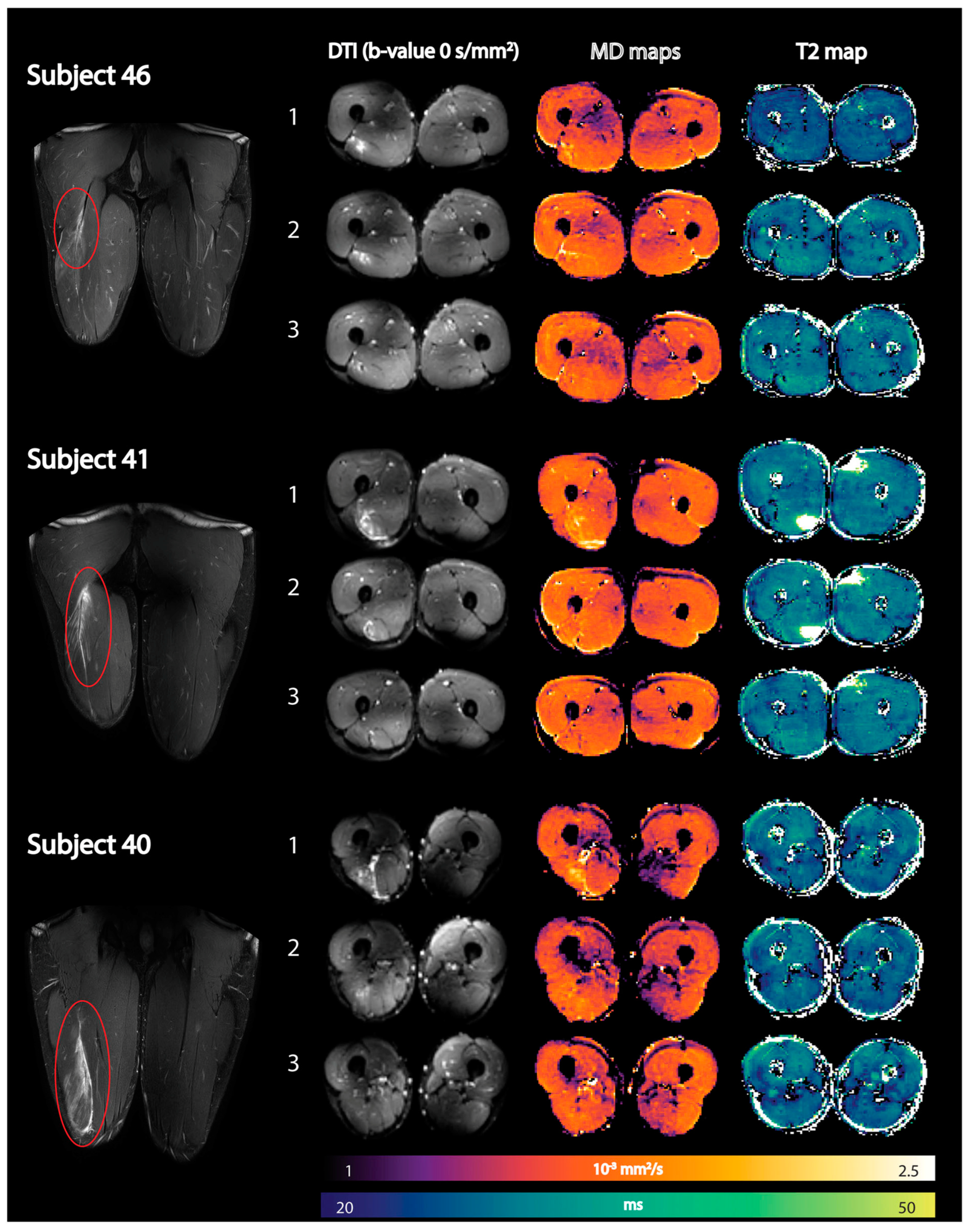 Tomography 10 00106 g009 Tomography 10 00106 g009