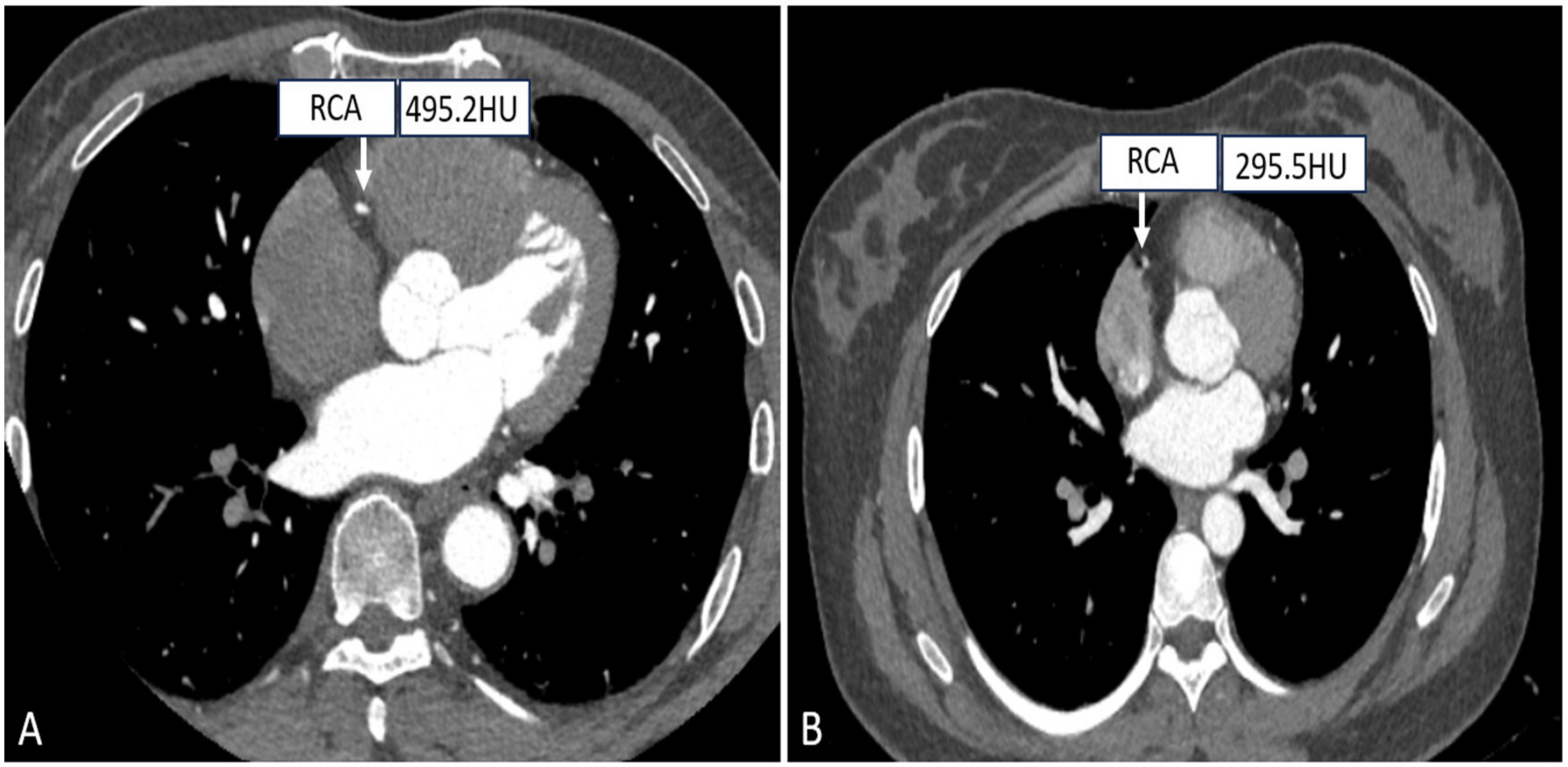 Tomography 10 00127 g004
