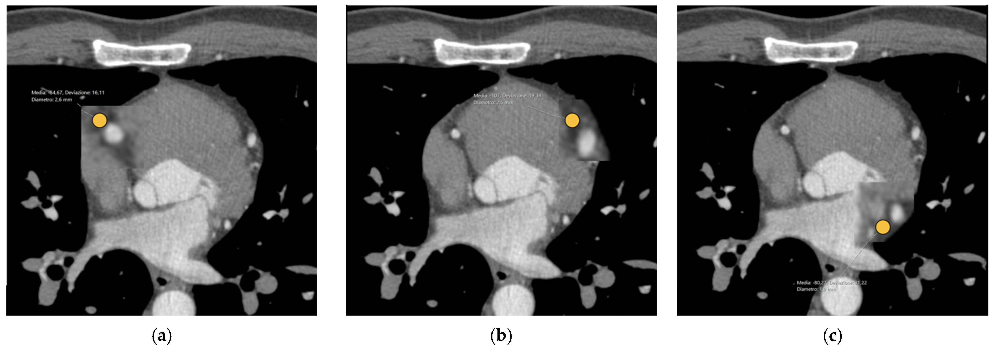 Tomography 10 00128 g002 Tomography 10 00128 g002