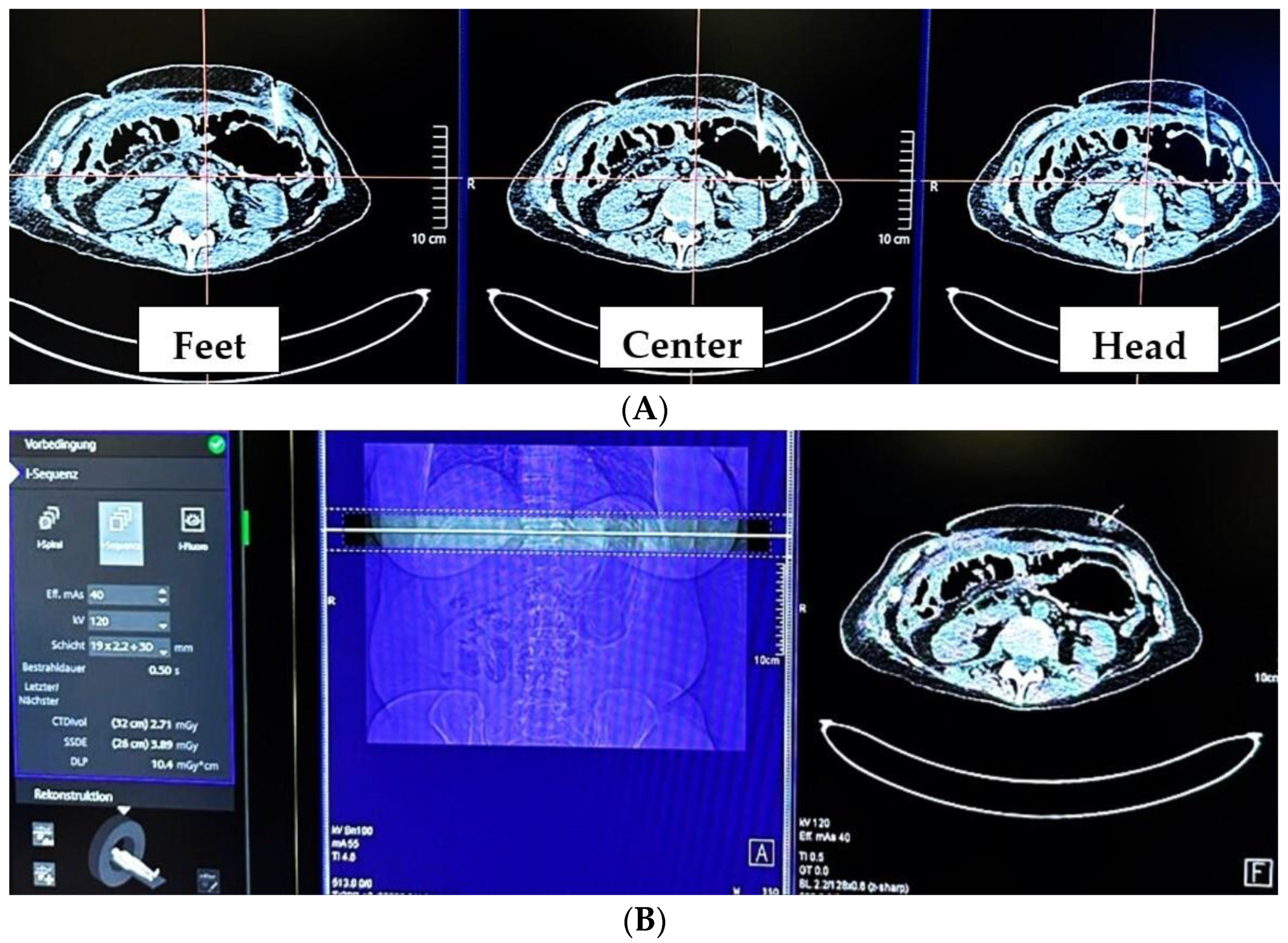 Tomography 10 00129 g002 Tomography 10 00129 g002