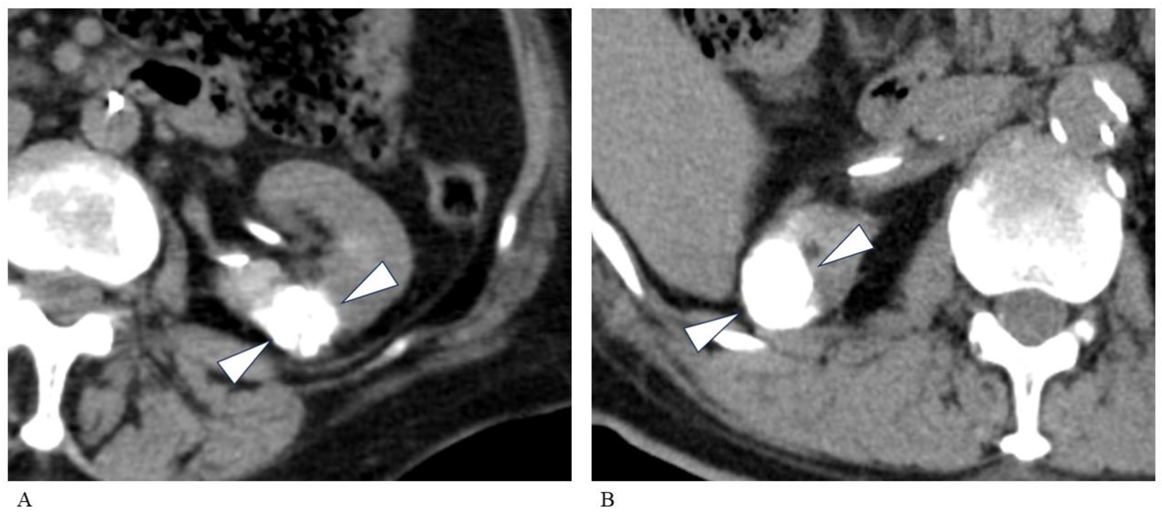 Tomography 10 00130 g001