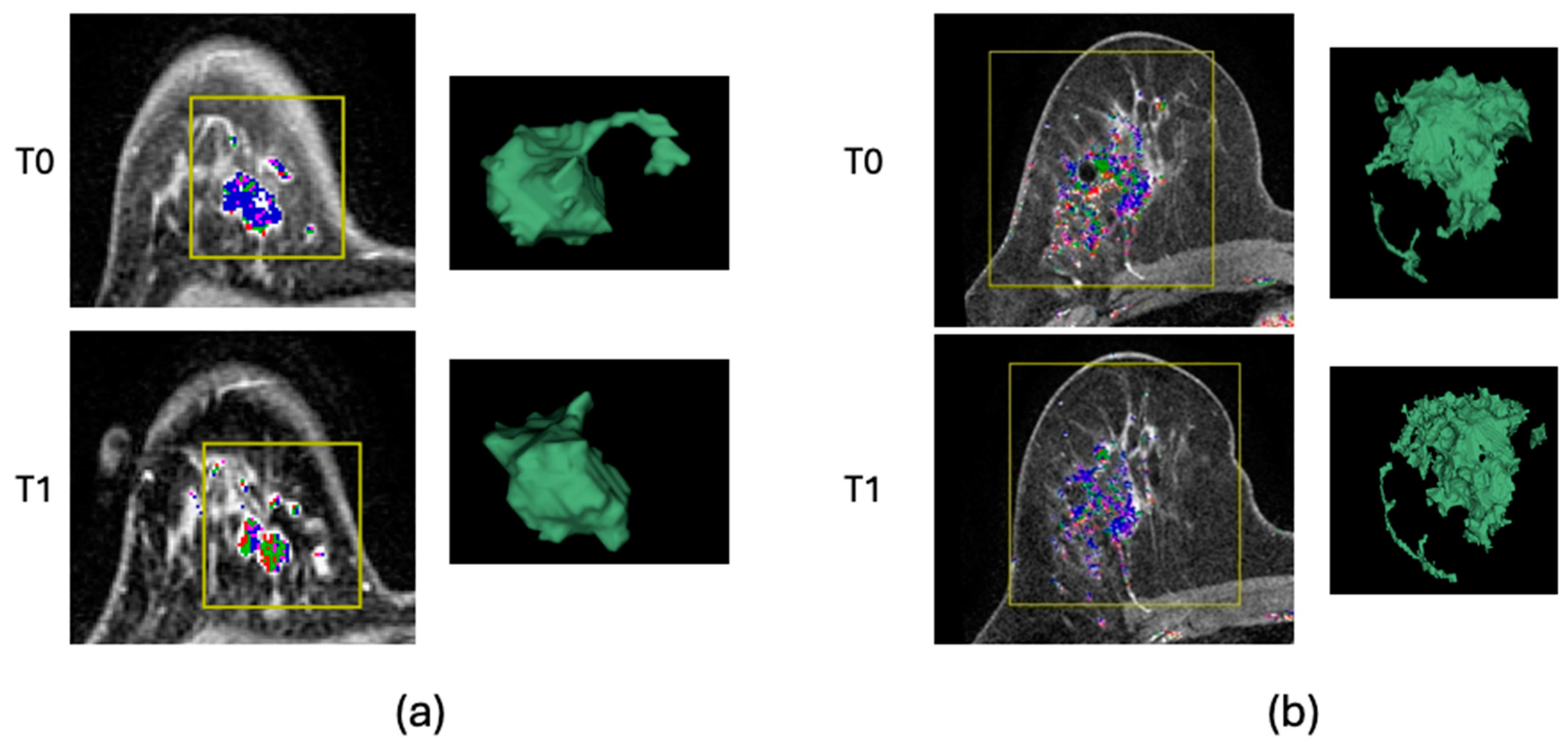Tomography 10 00134 g006