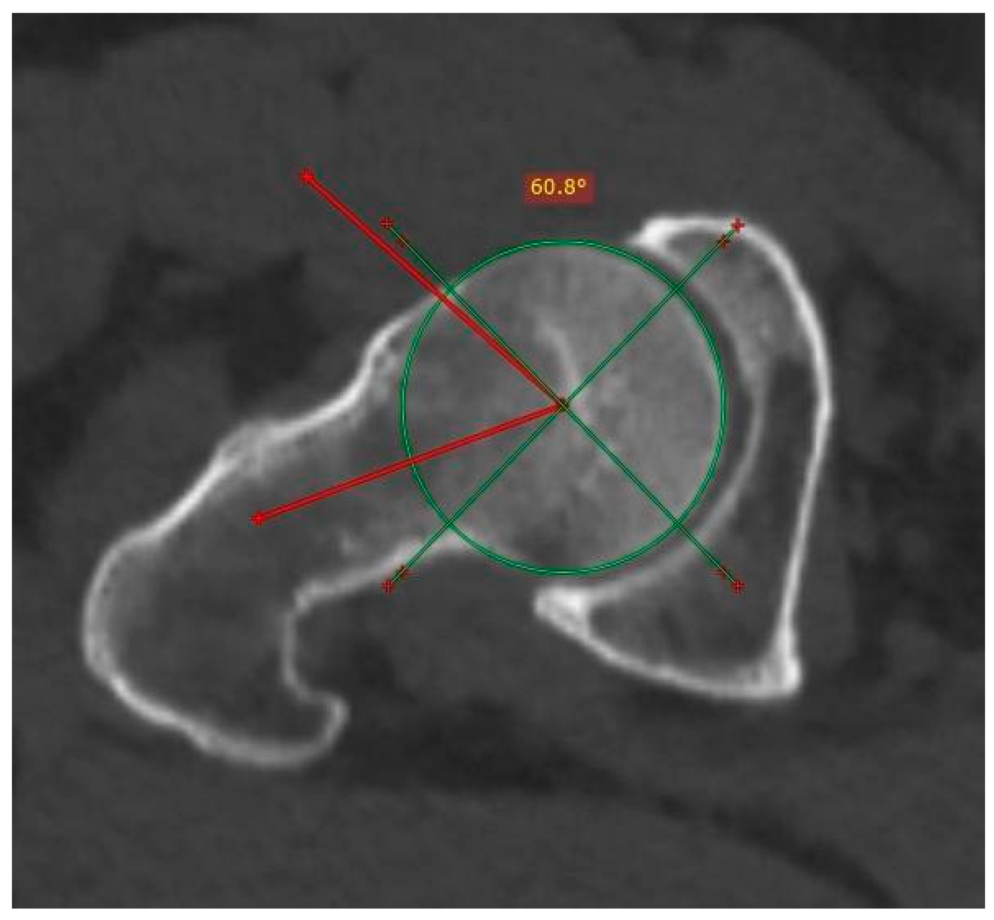 Tomography 10 00141 g004