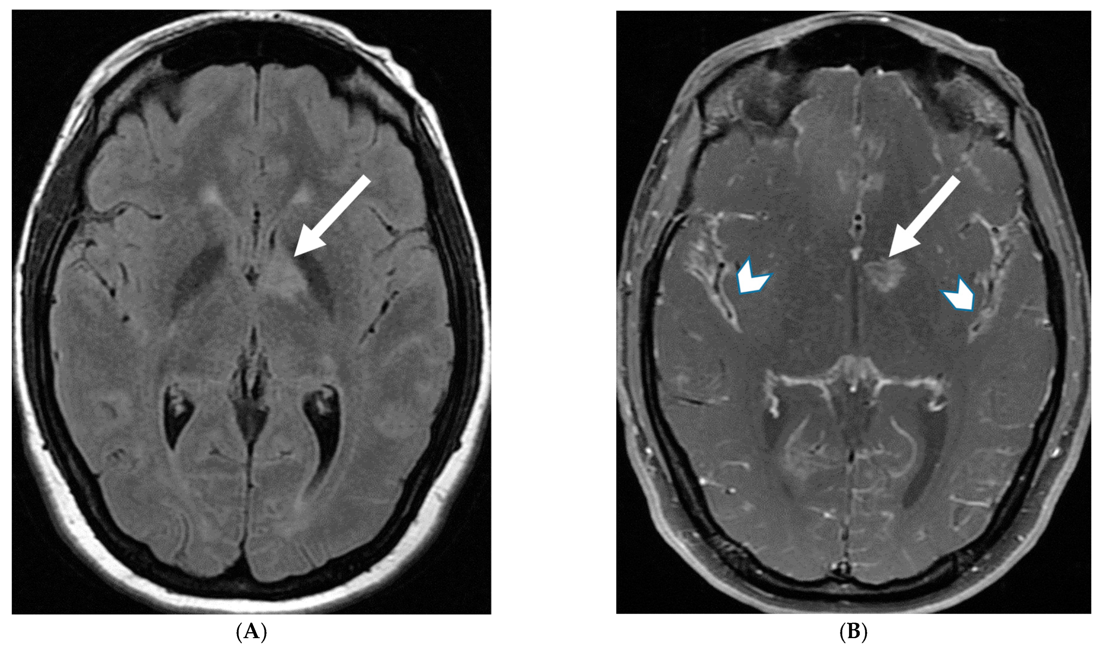 Tomography 10 00143 g003a Tomography 10 00143 g003a