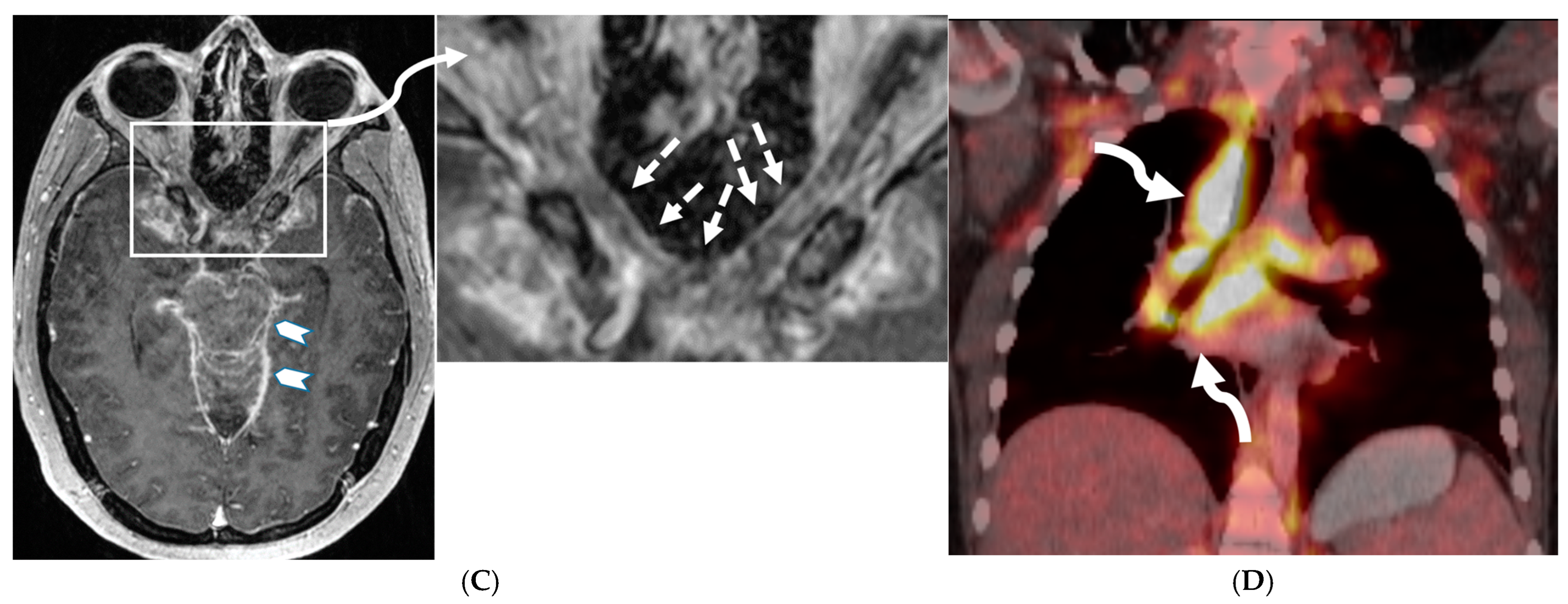 Tomography 10 00143 g003b Tomography 10 00143 g003b