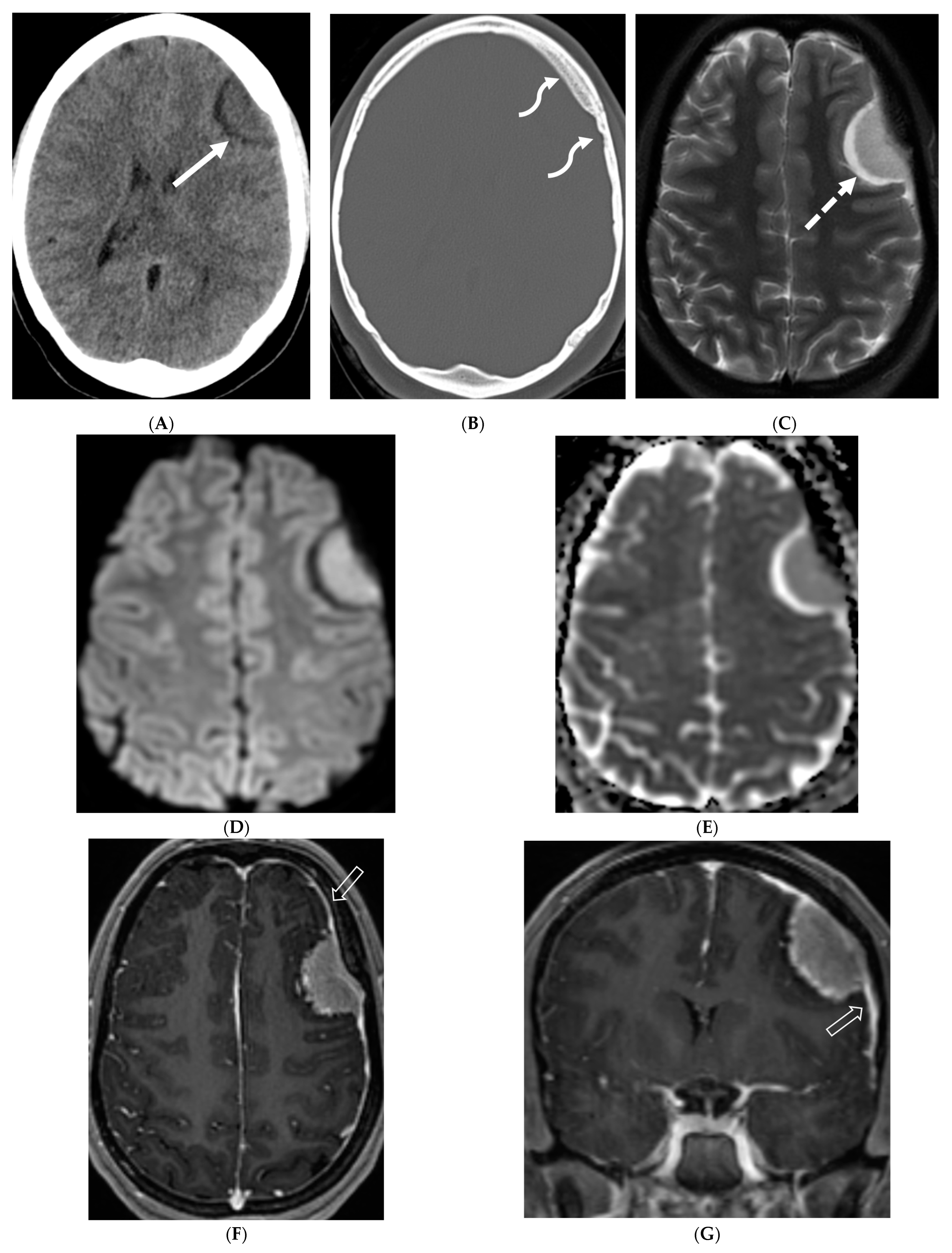 Tomography 10 00143 g005 Tomography 10 00143 g005