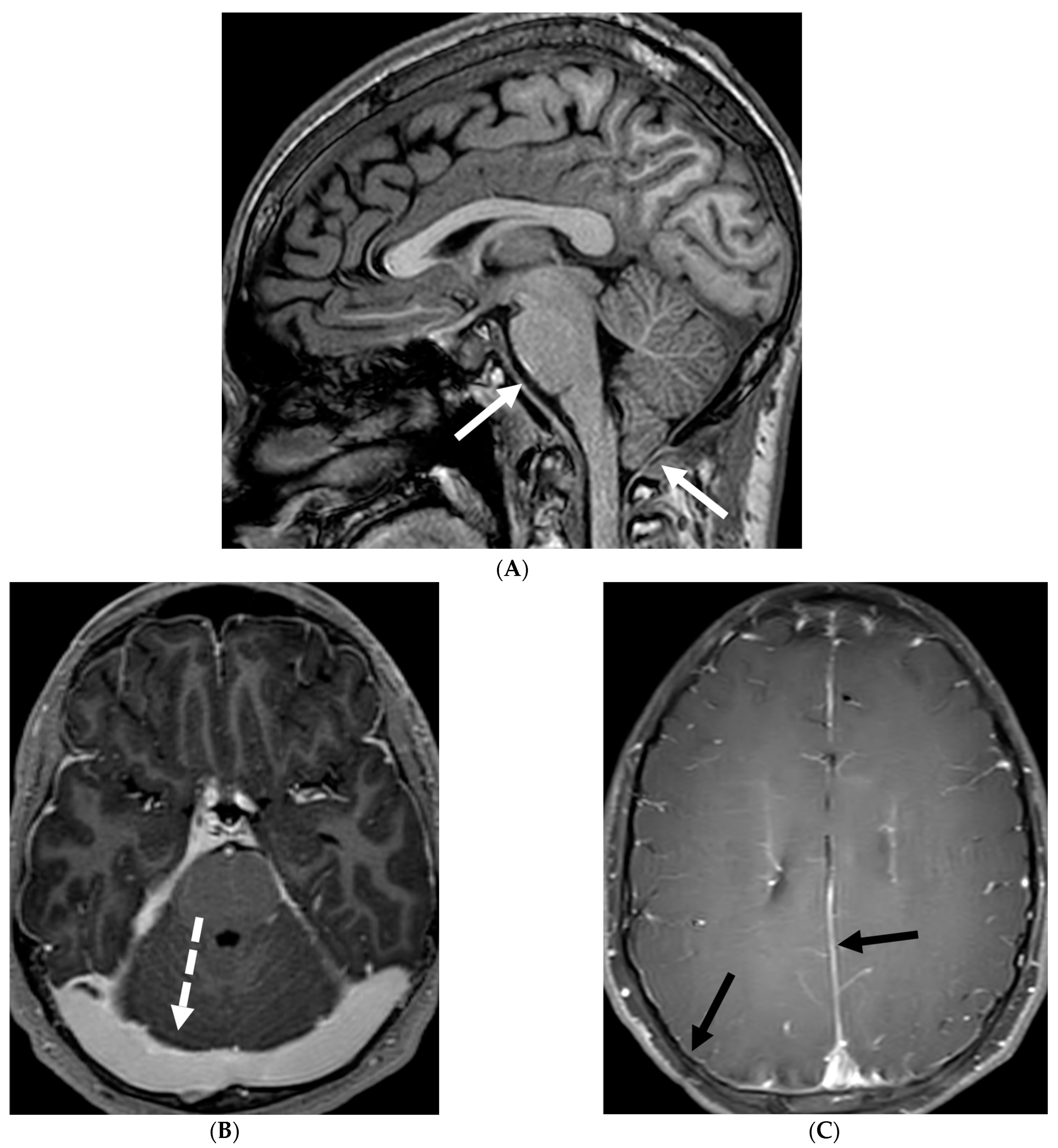 Tomography 10 00143 g008a Tomography 10 00143 g008a