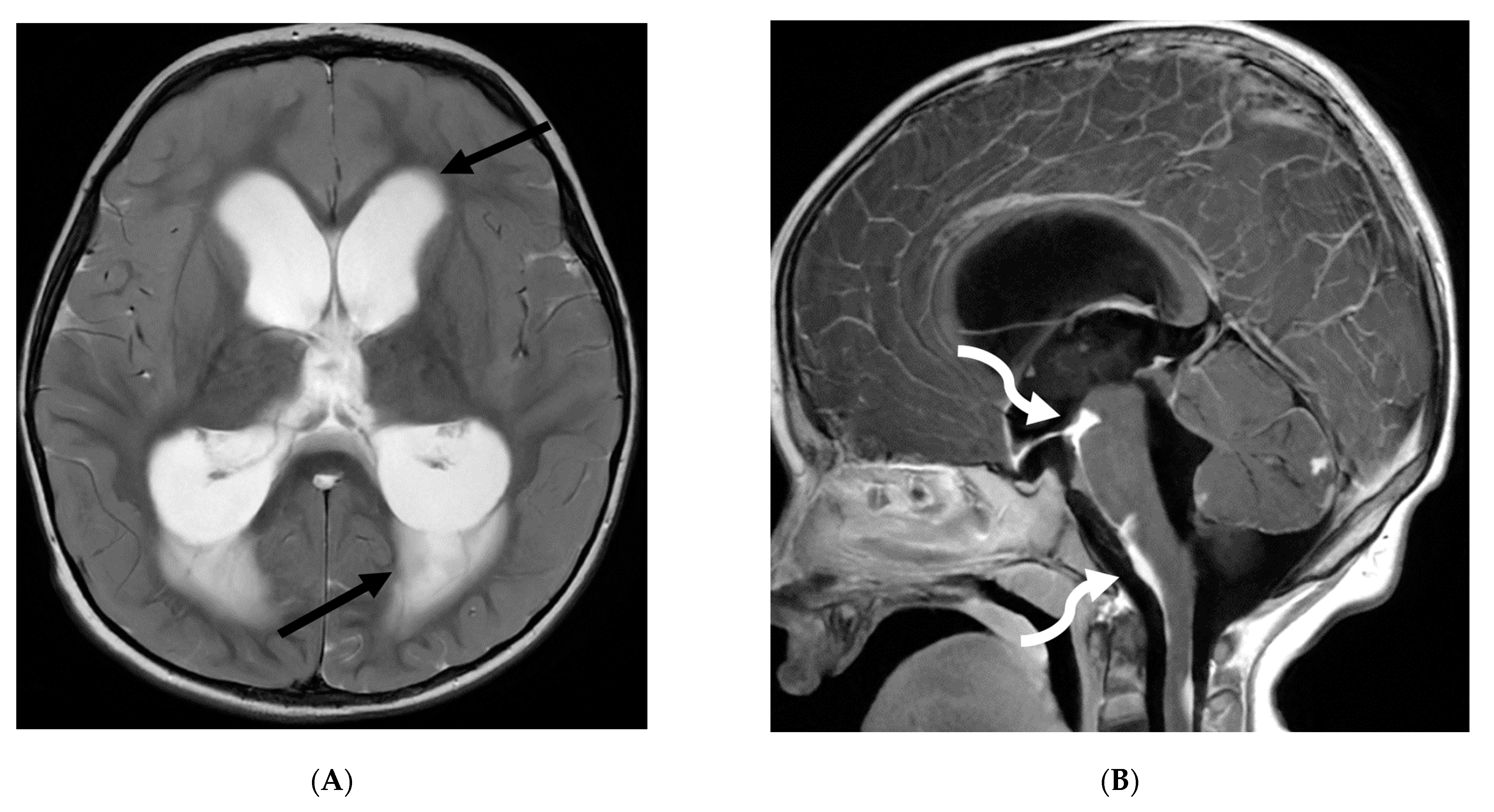 Tomography 10 00143 g010a Tomography 10 00143 g010a