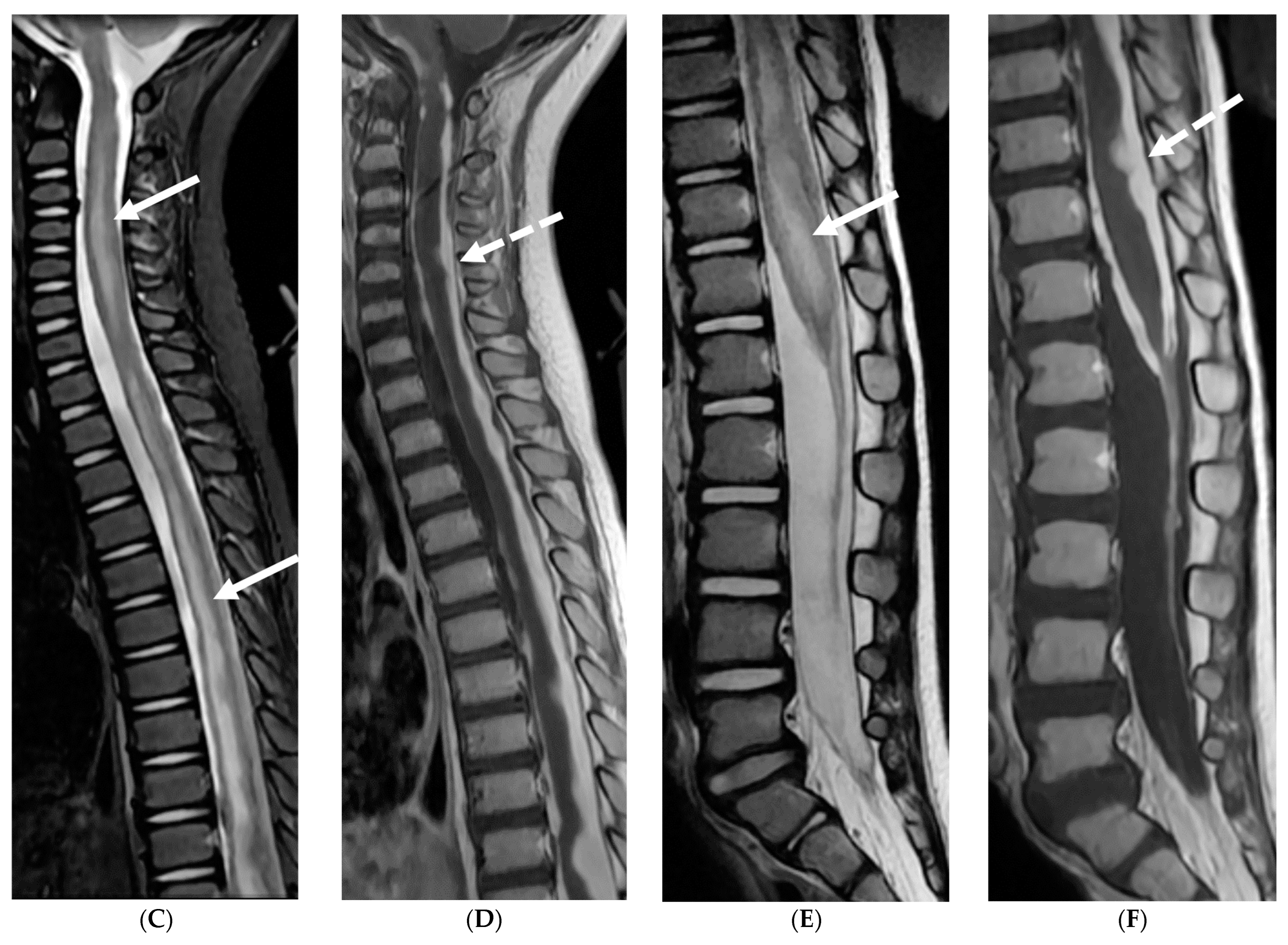 Tomography 10 00143 g010b Tomography 10 00143 g010b