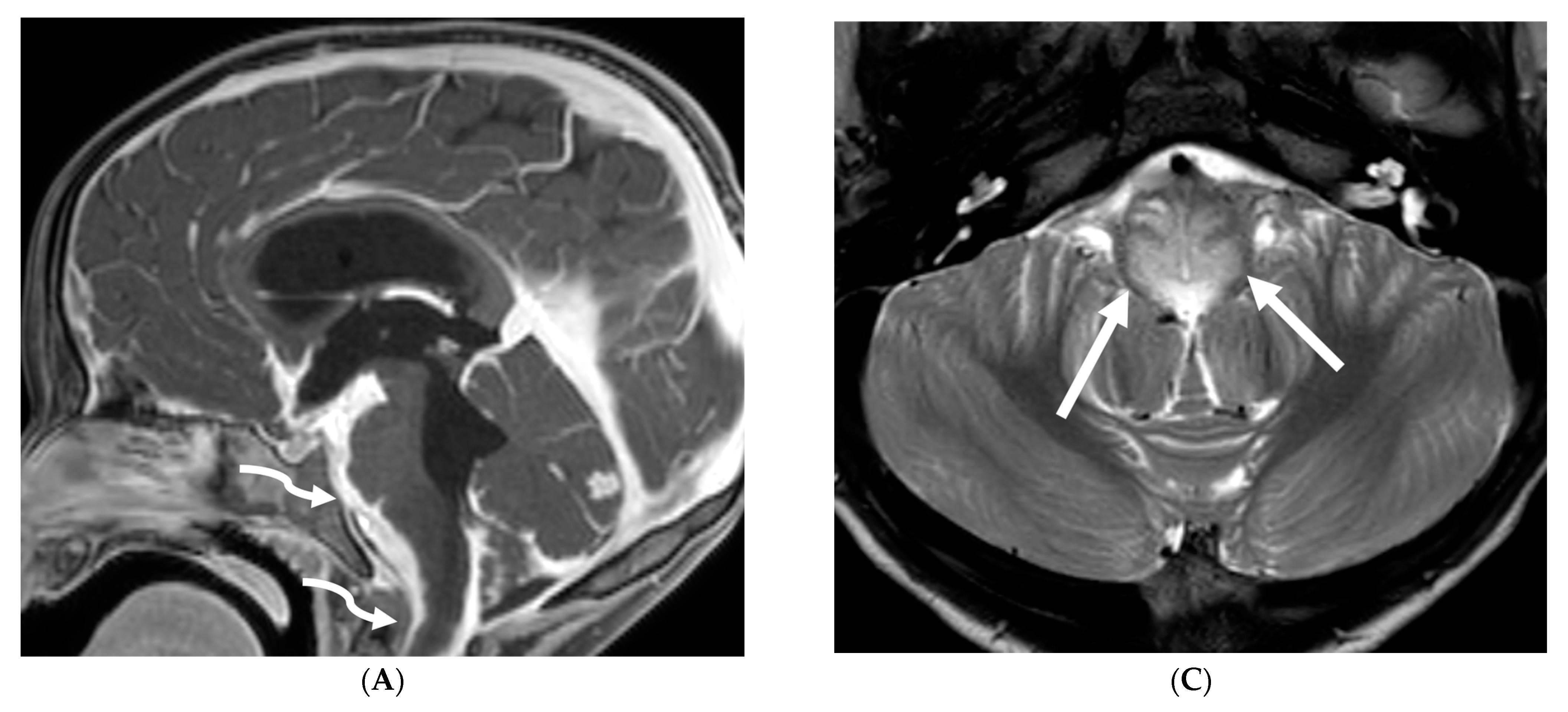 Tomography 10 00143 g011a Tomography 10 00143 g011a