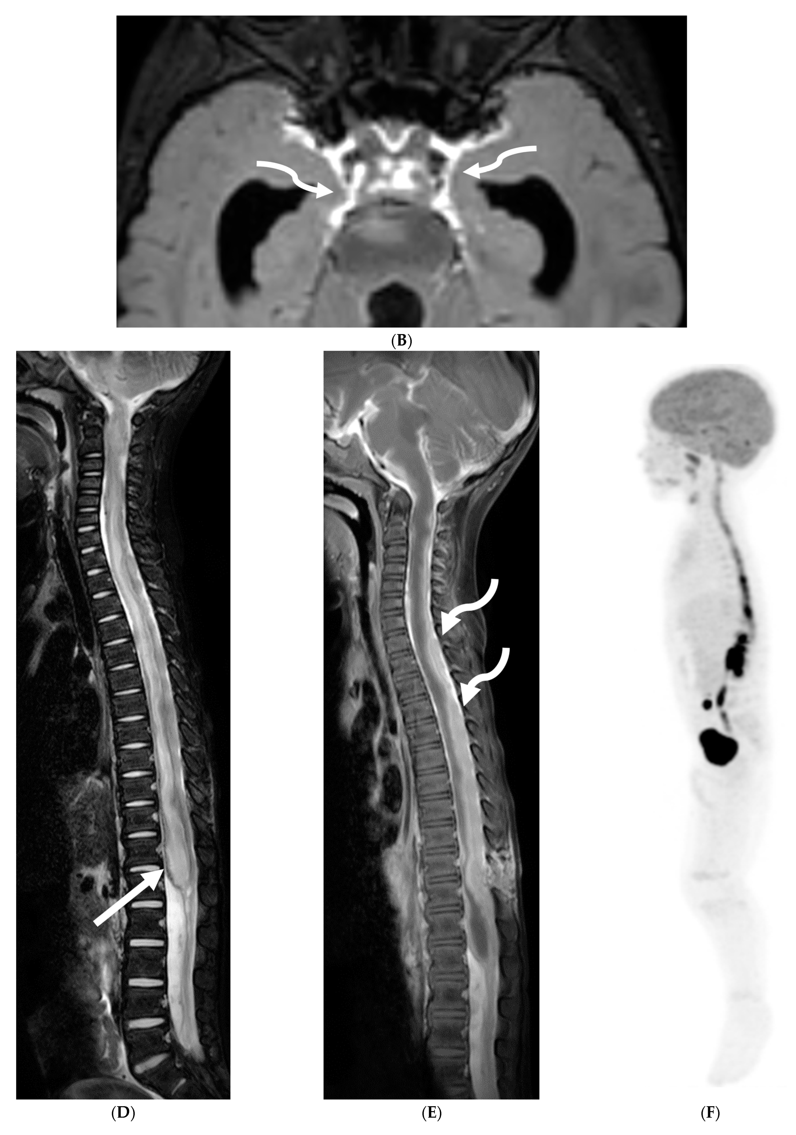 Tomography 10 00143 g011b Tomography 10 00143 g011b