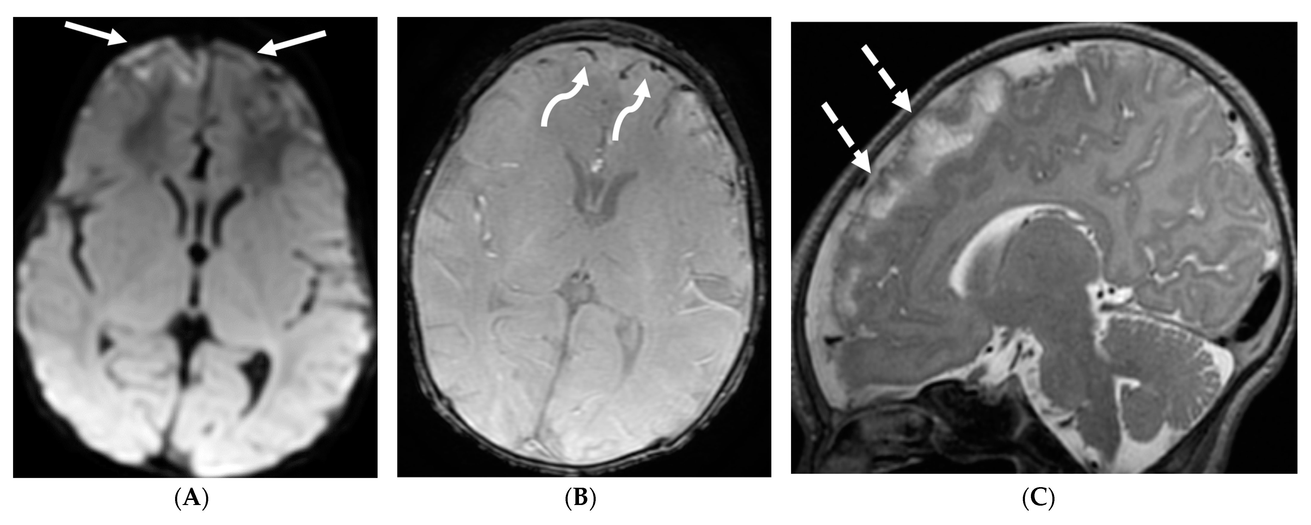 Tomography 10 00143 g012a Tomography 10 00143 g012a