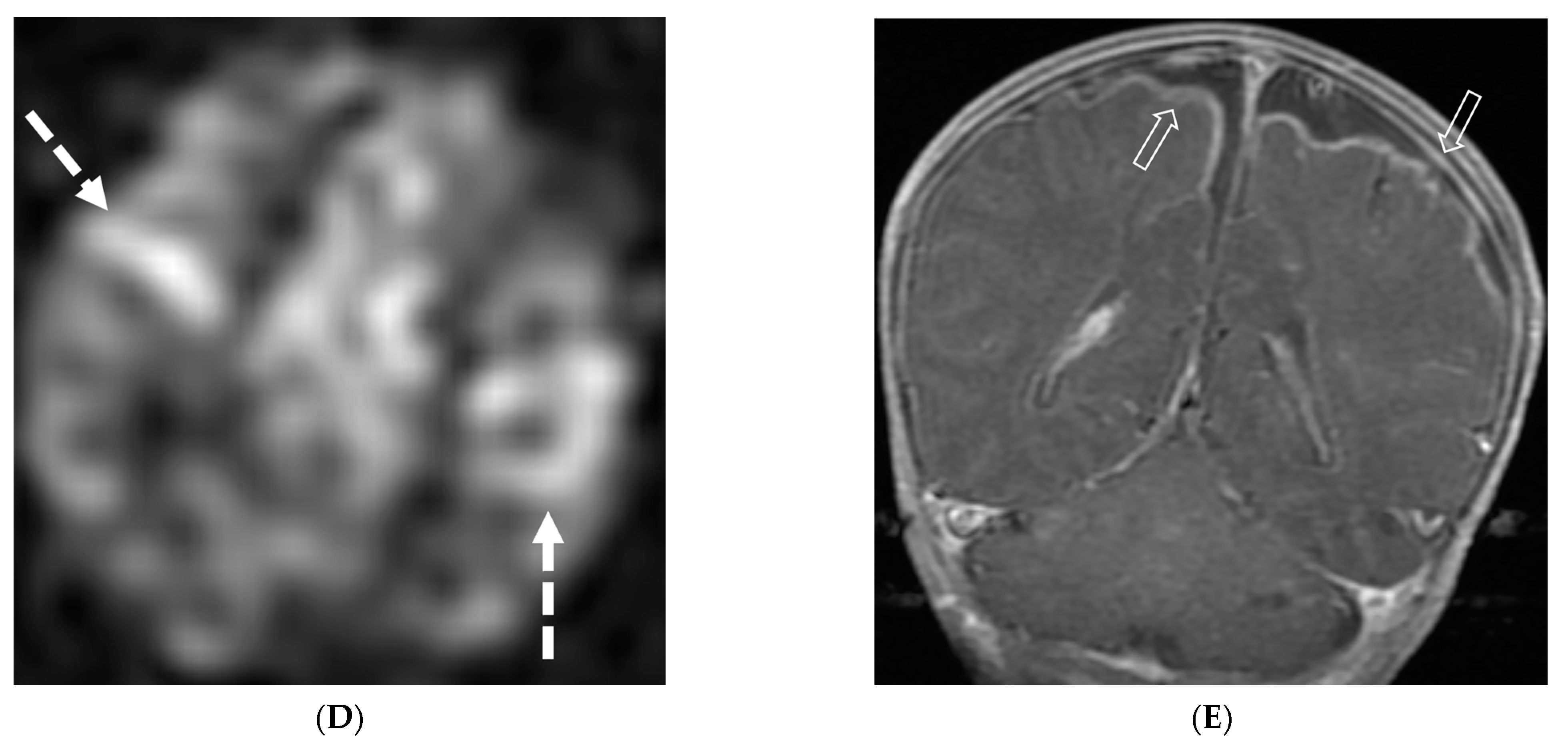 Tomography 10 00143 g012b Tomography 10 00143 g012b