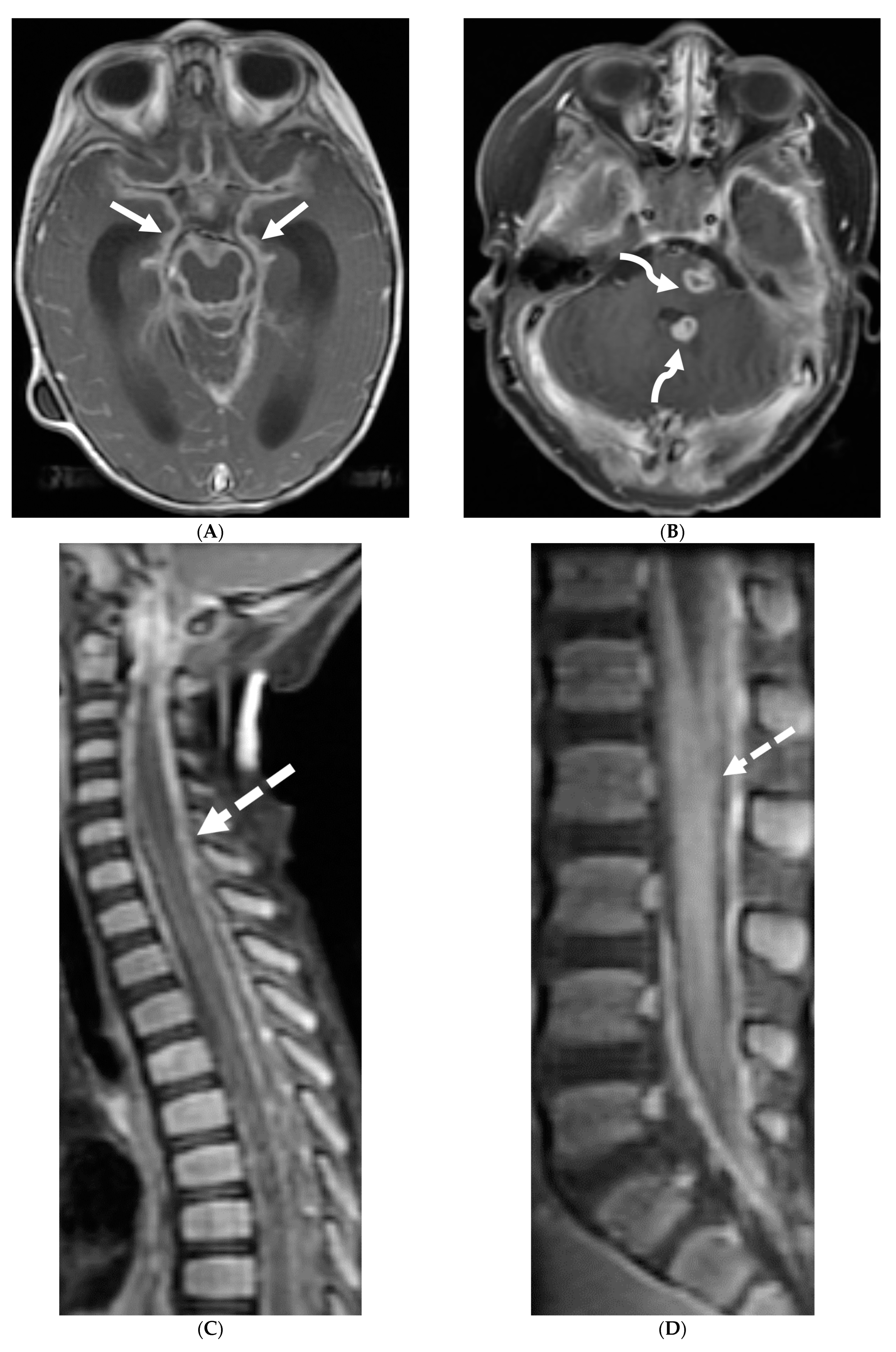 Tomography 10 00143 g013 Tomography 10 00143 g013