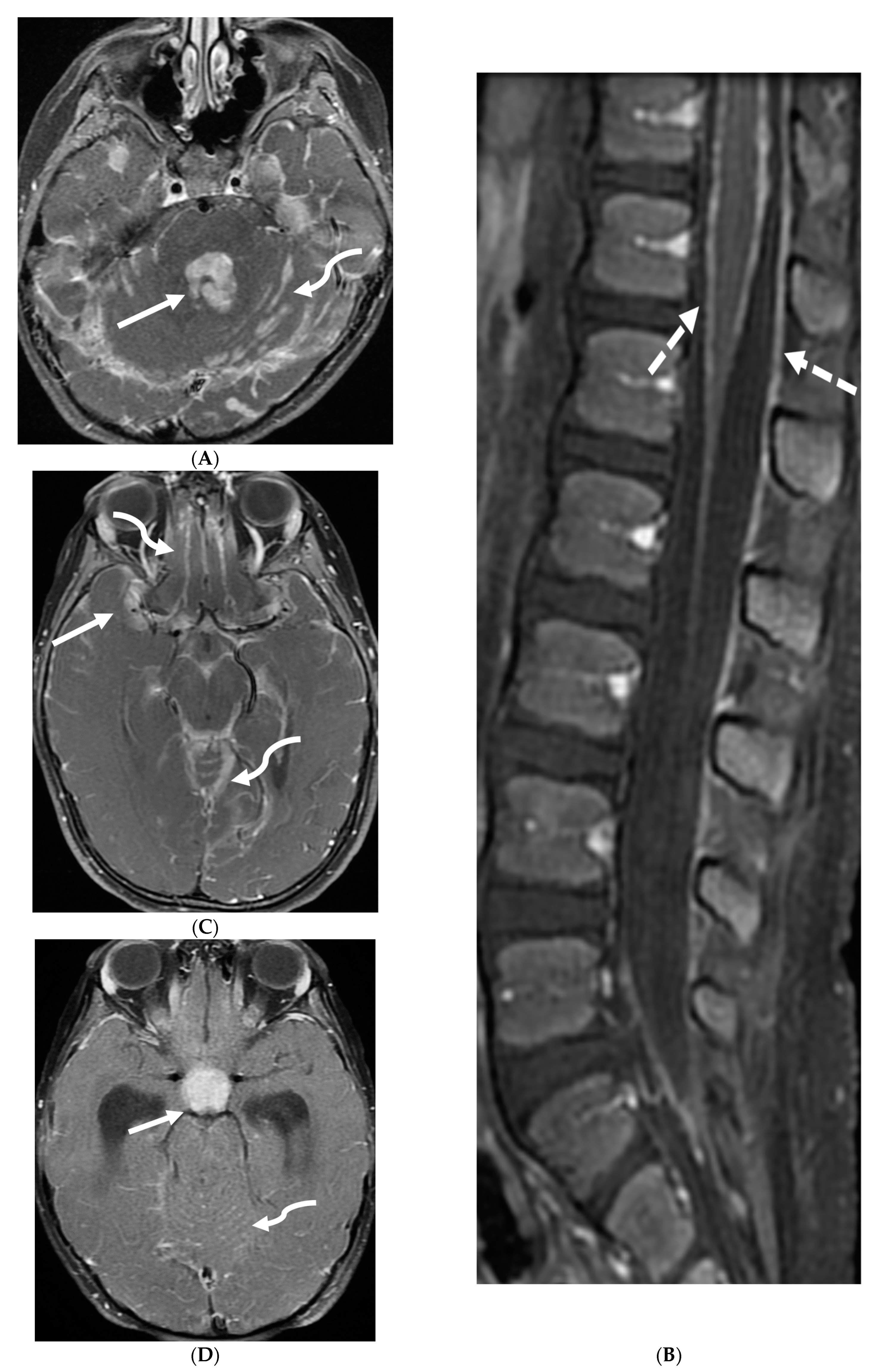Tomography 10 00143 g014 Tomography 10 00143 g014