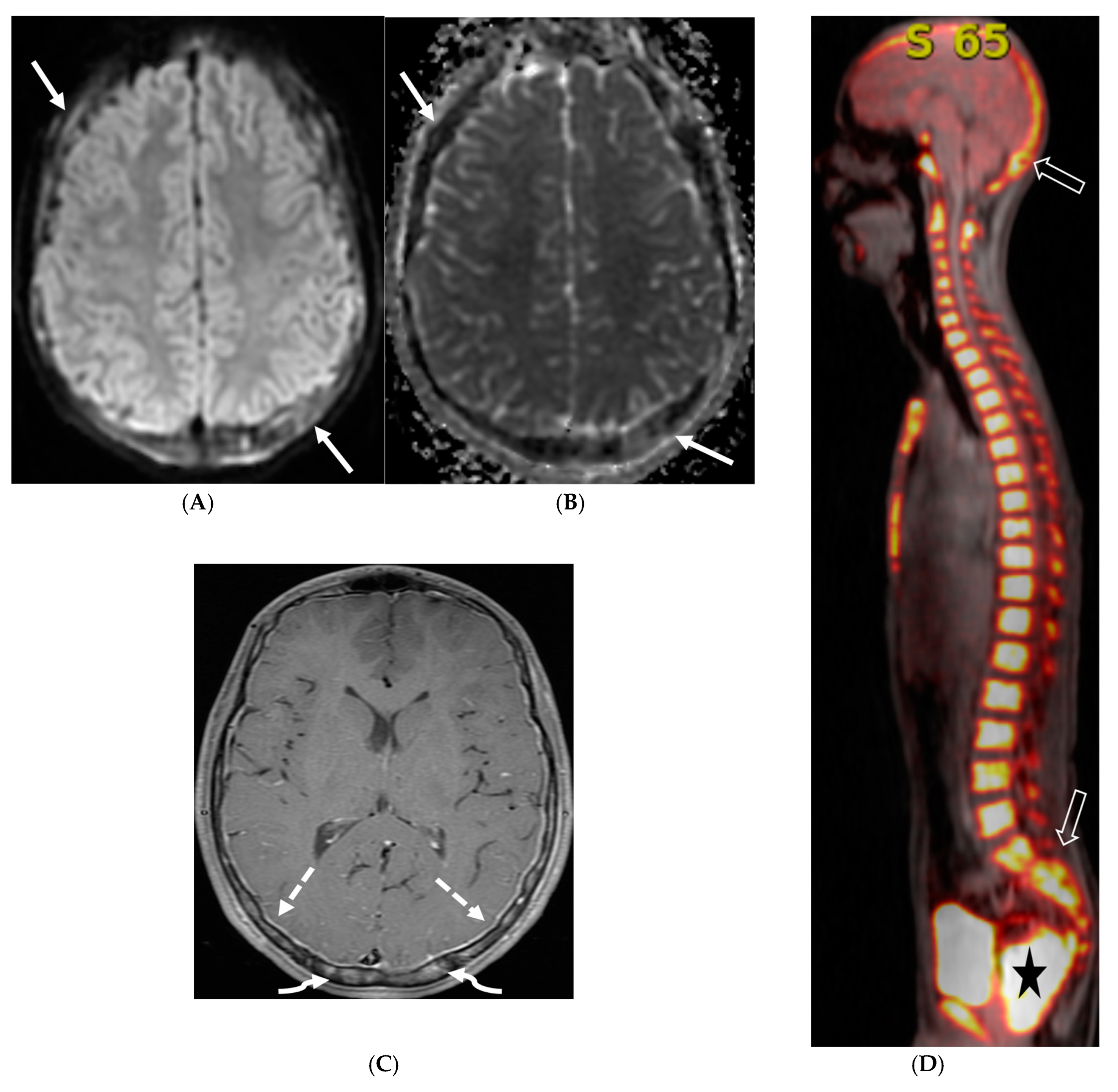 Tomography 10 00143 g015 Tomography 10 00143 g015
