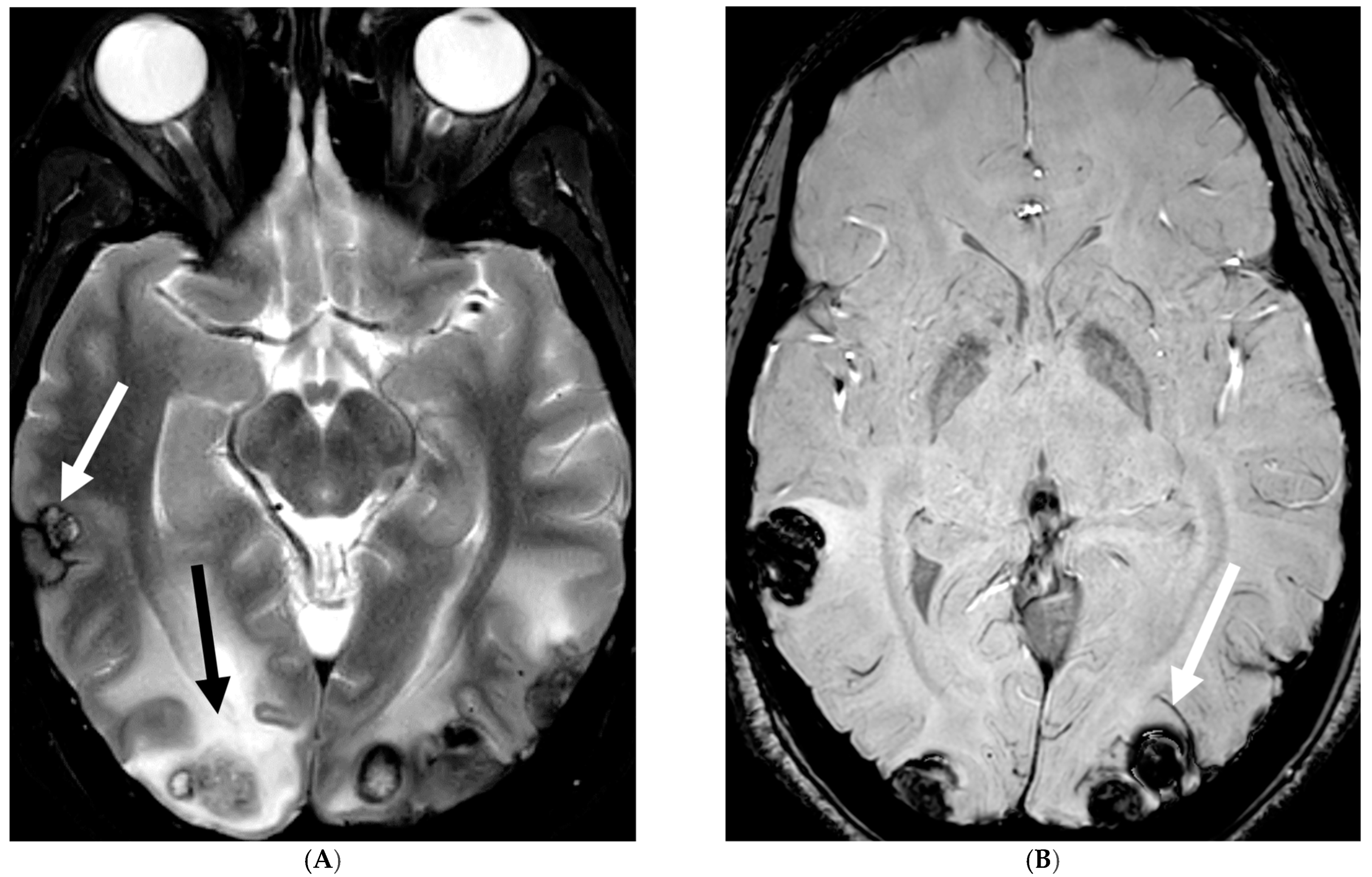 Tomography 10 00143 g017a Tomography 10 00143 g017a