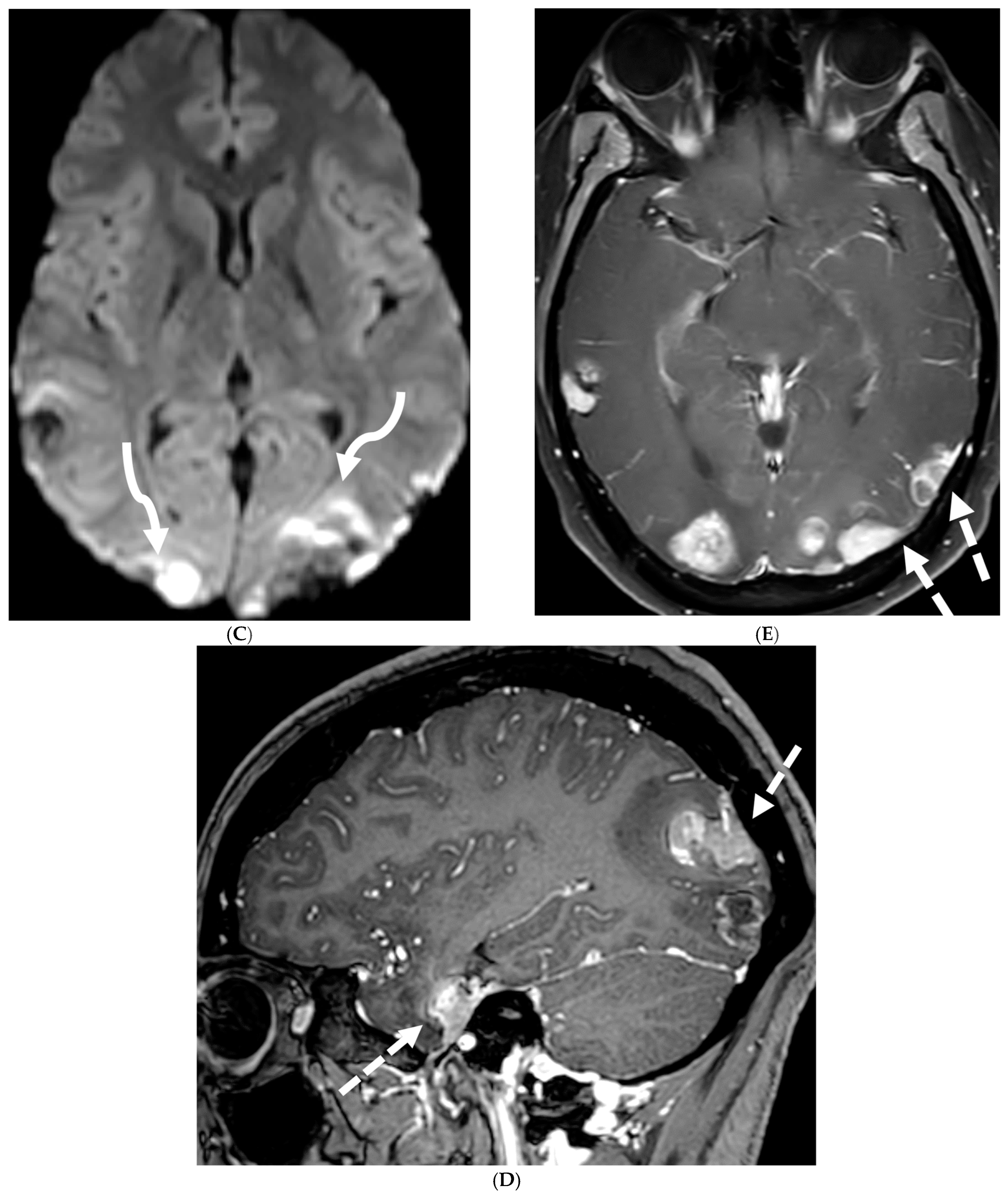 Tomography 10 00143 g017b Tomography 10 00143 g017b