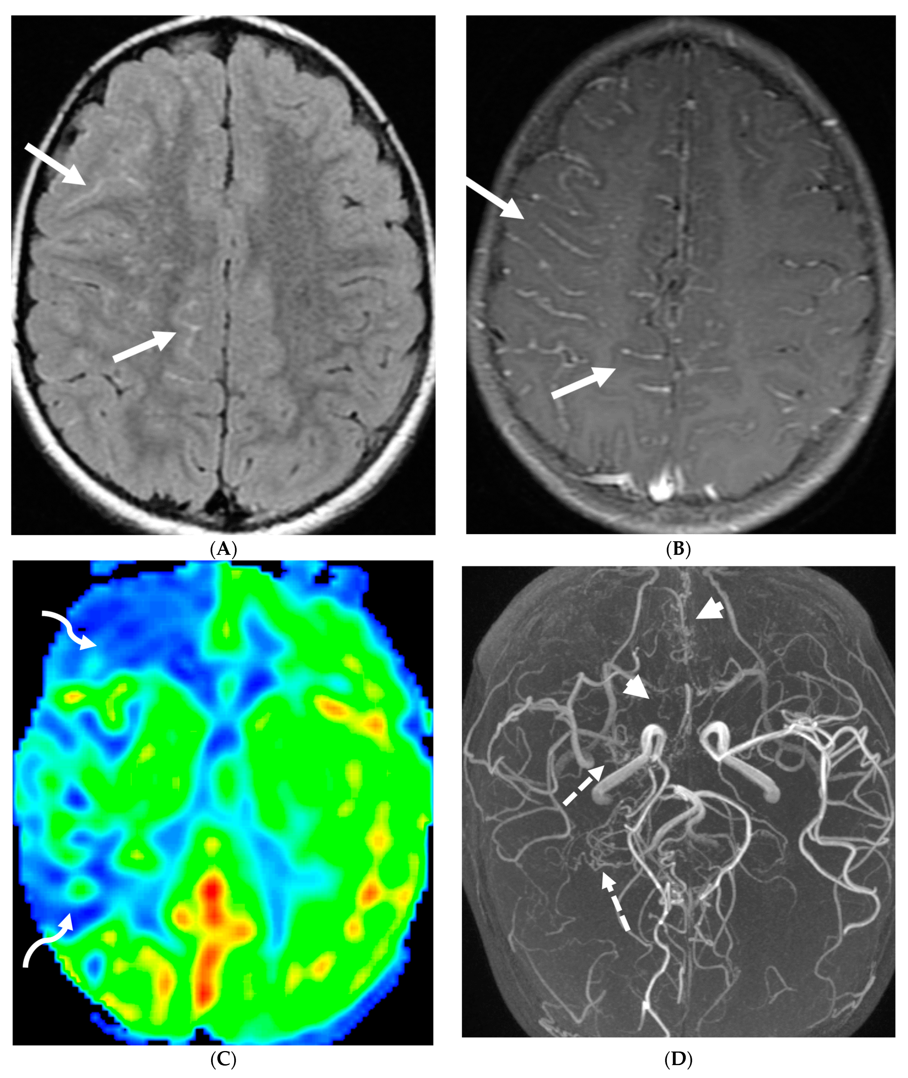 Tomography 10 00143 g018 Tomography 10 00143 g018