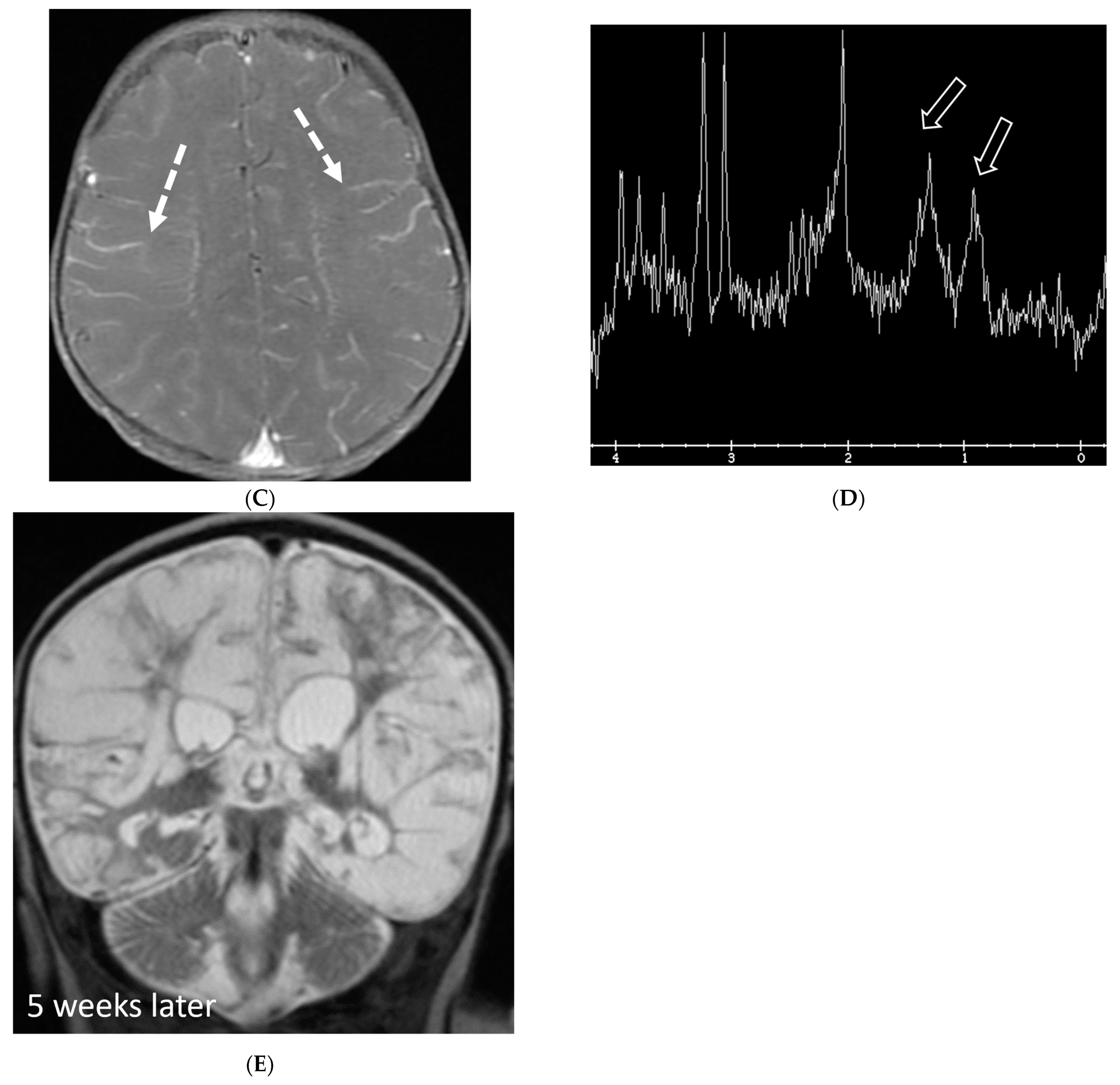 Tomography 10 00143 g019b Tomography 10 00143 g019b