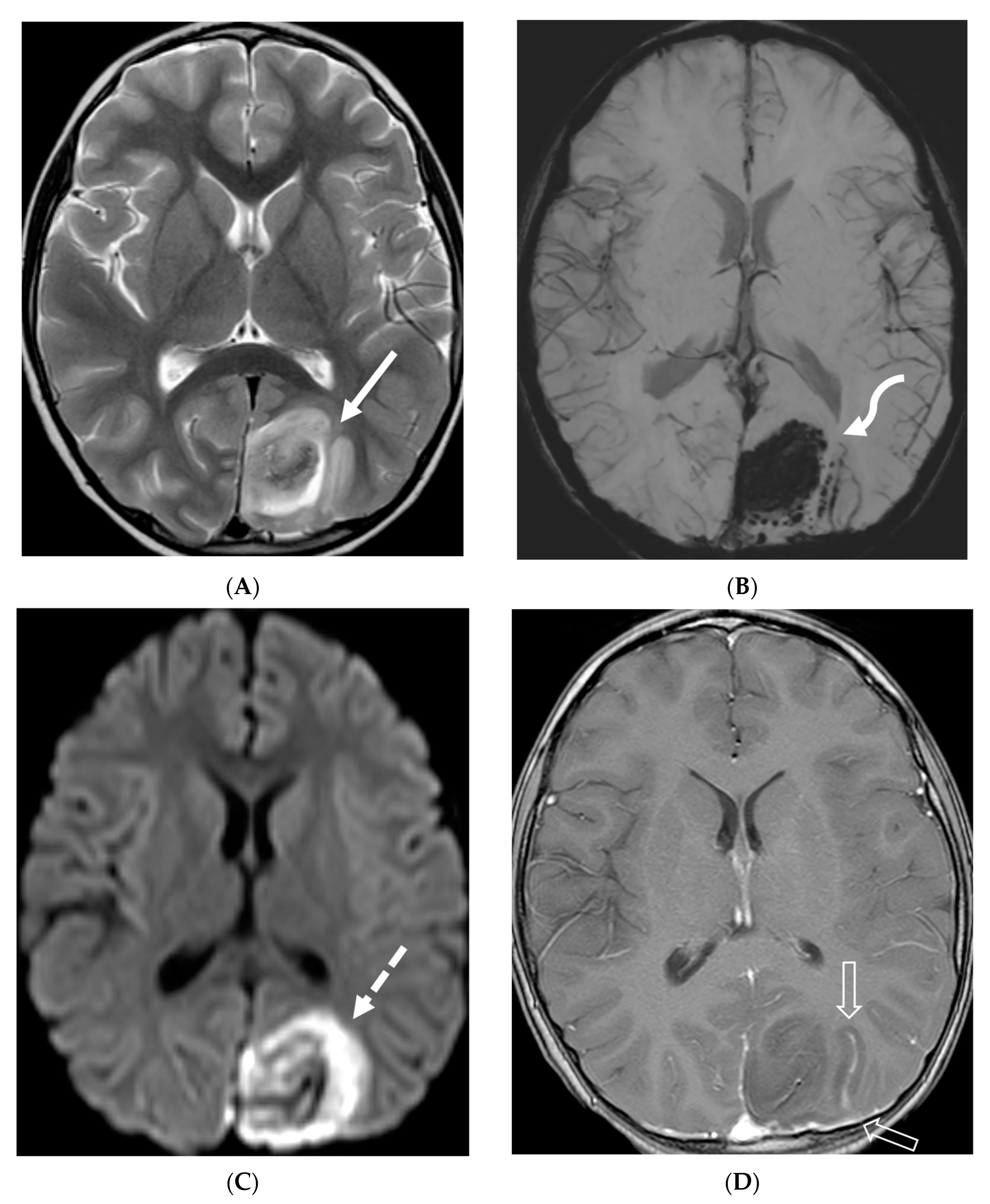 Tomography 10 00143 g020 Tomography 10 00143 g020