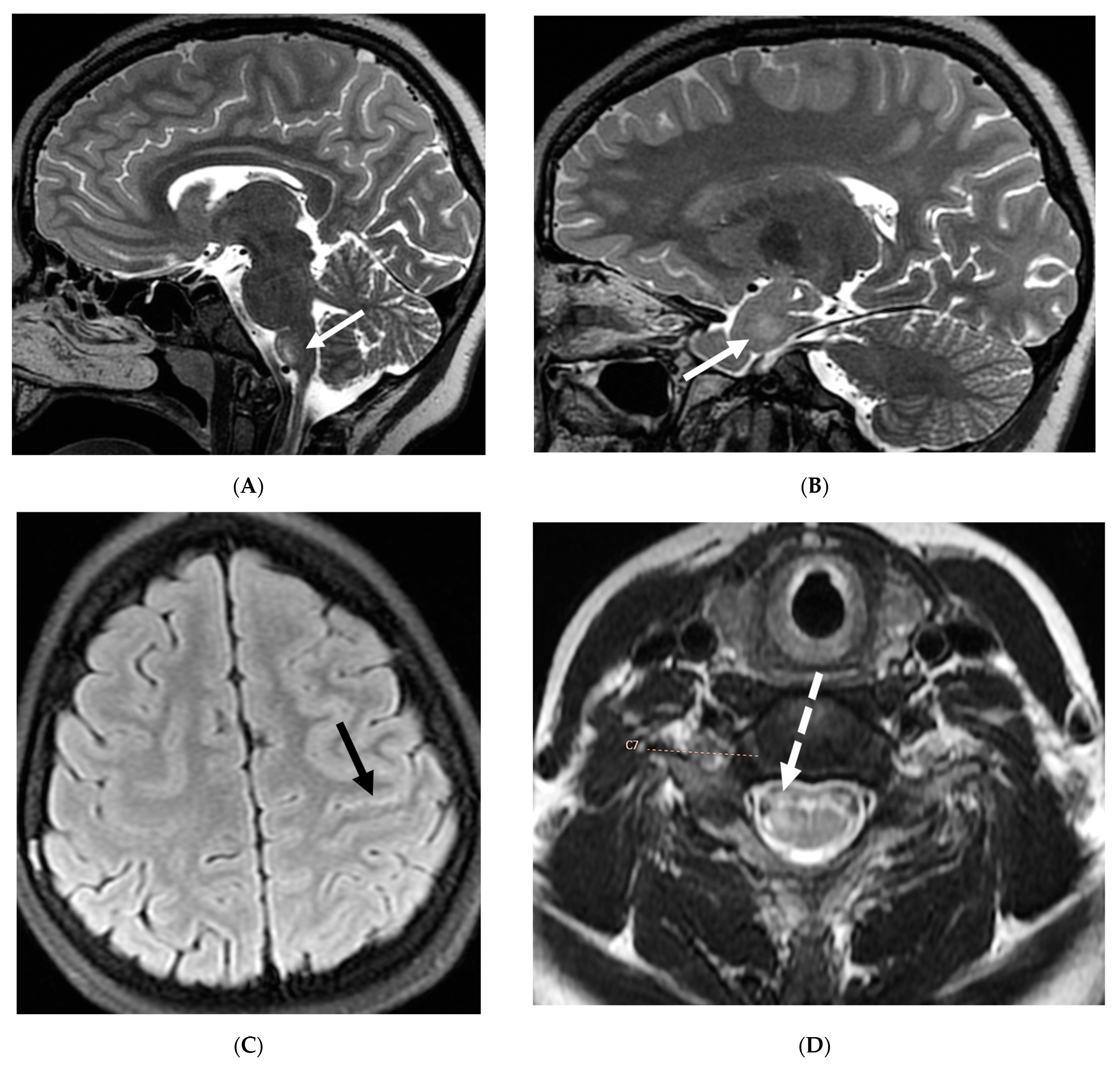 Tomography 10 00143 g021a Tomography 10 00143 g021a