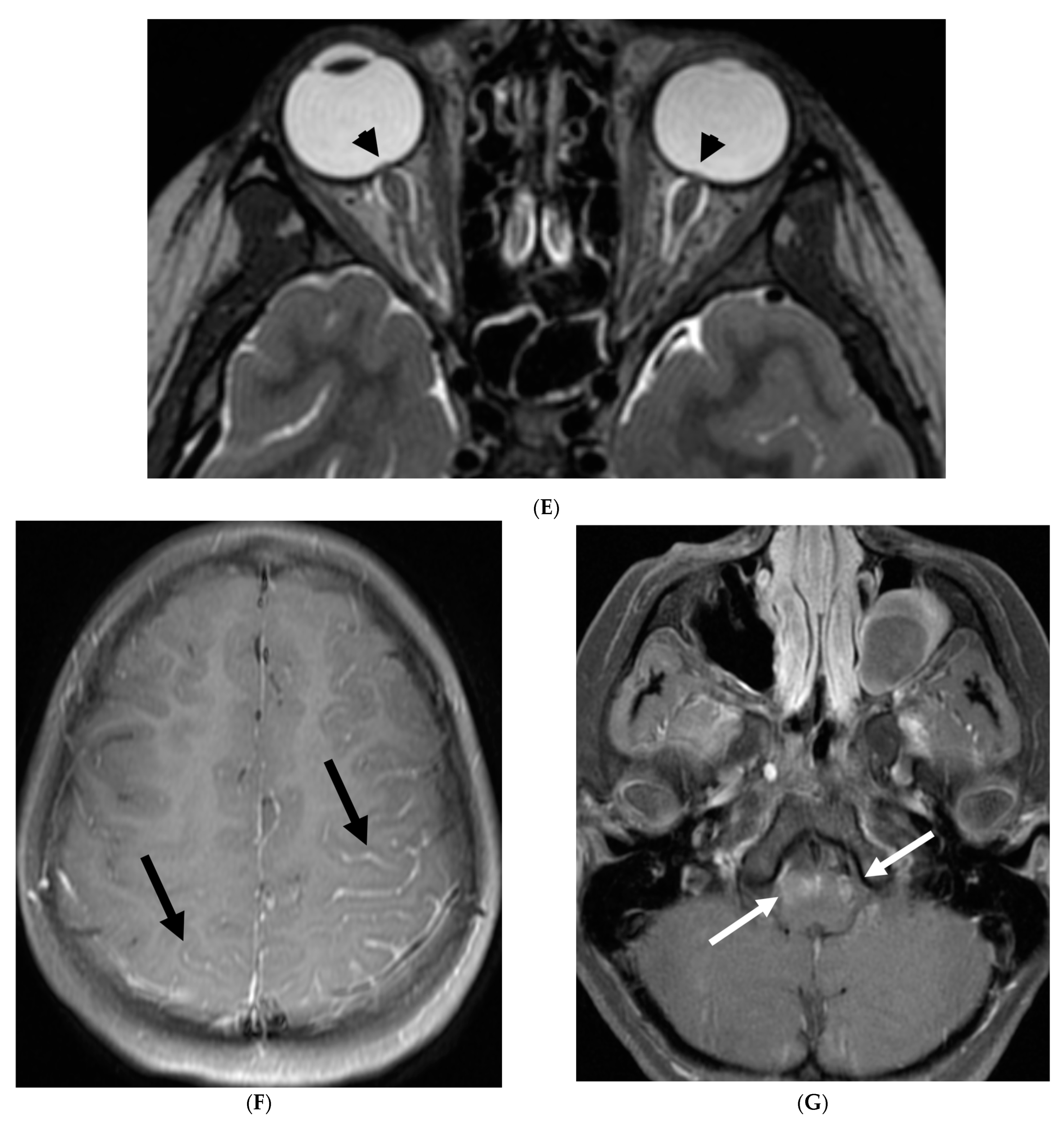 Tomography 10 00143 g021b Tomography 10 00143 g021b