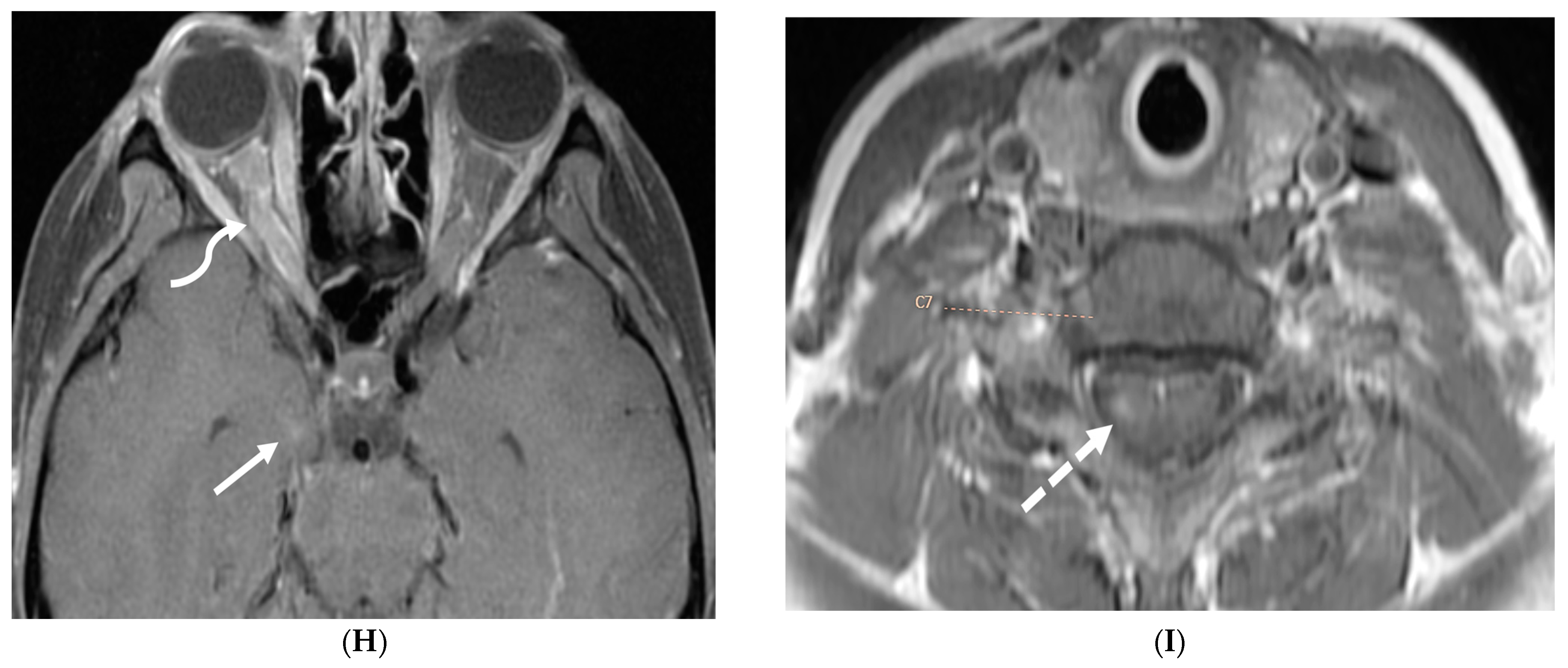 Tomography 10 00143 g021c Tomography 10 00143 g021c