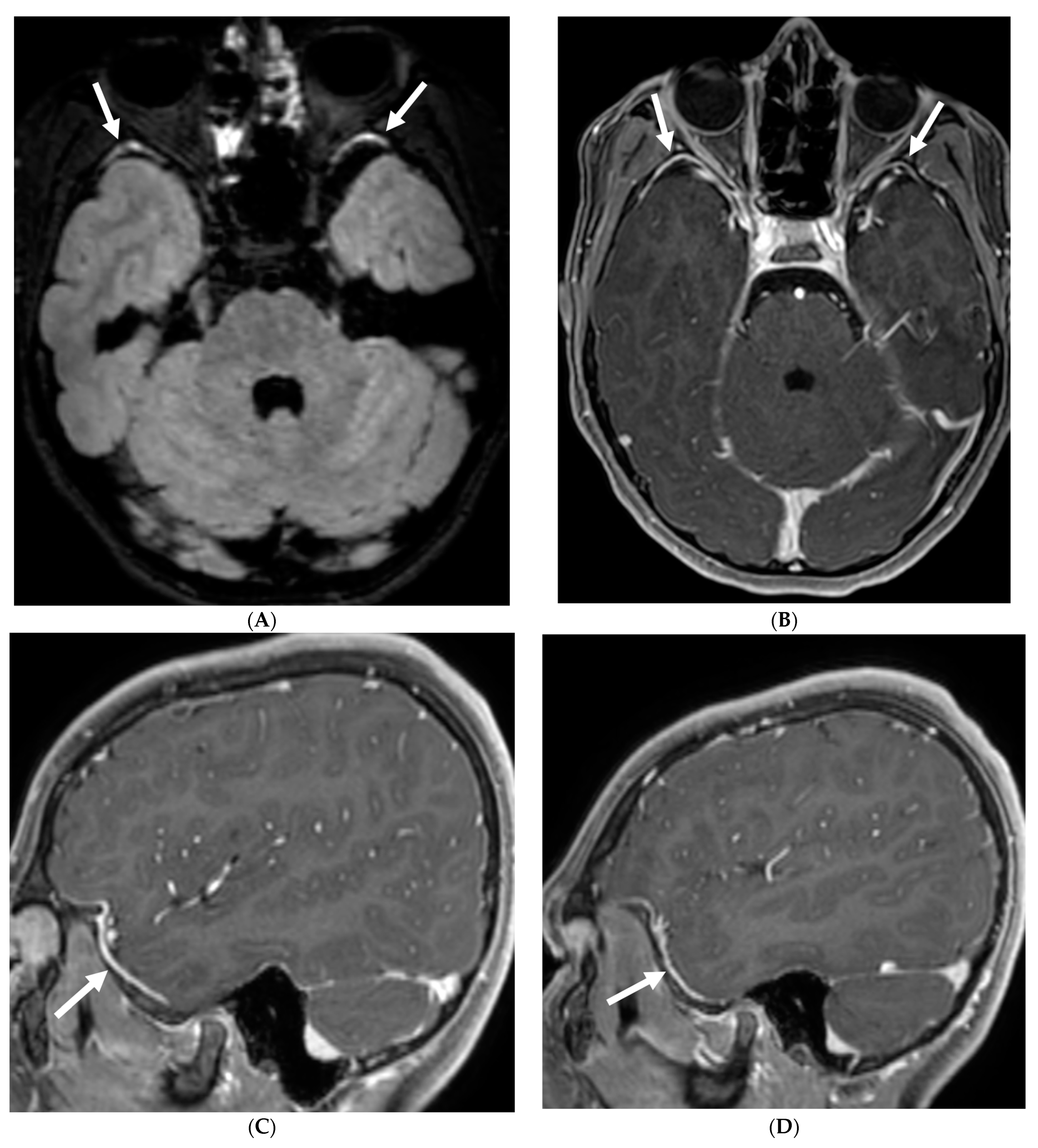 Tomography 10 00143 g022 Tomography 10 00143 g022