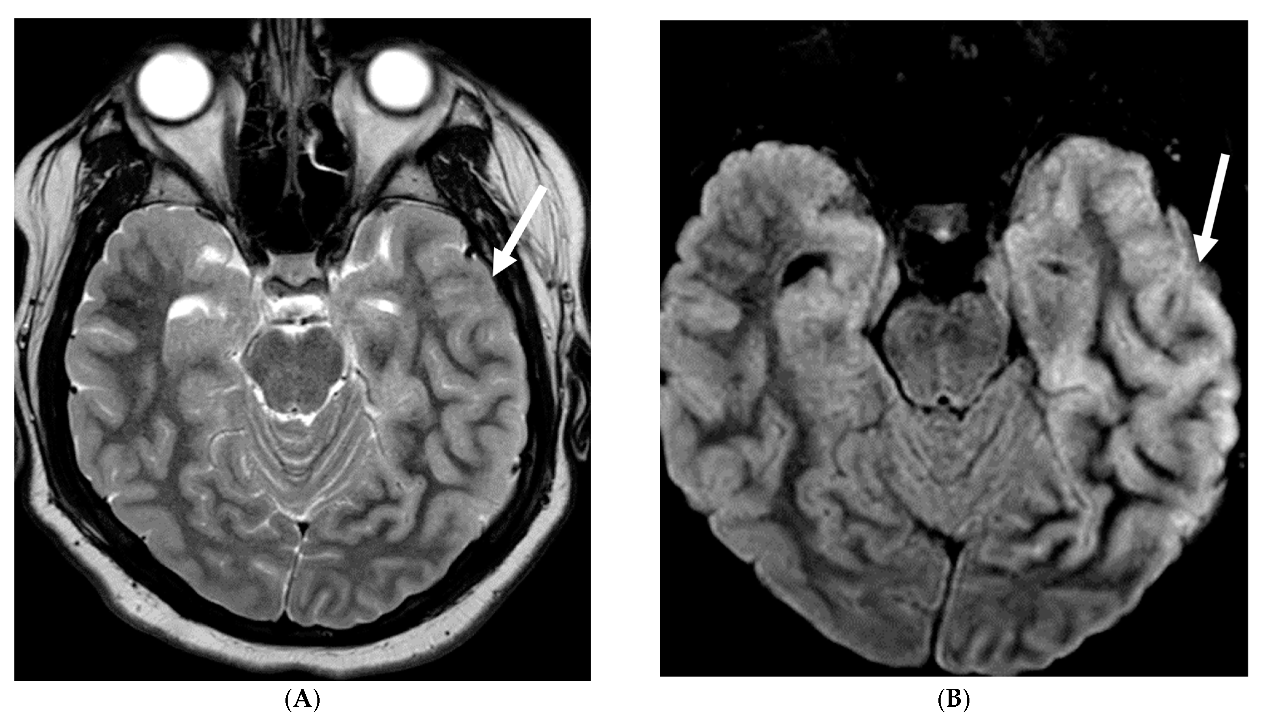 Tomography 10 00143 g023a Tomography 10 00143 g023a