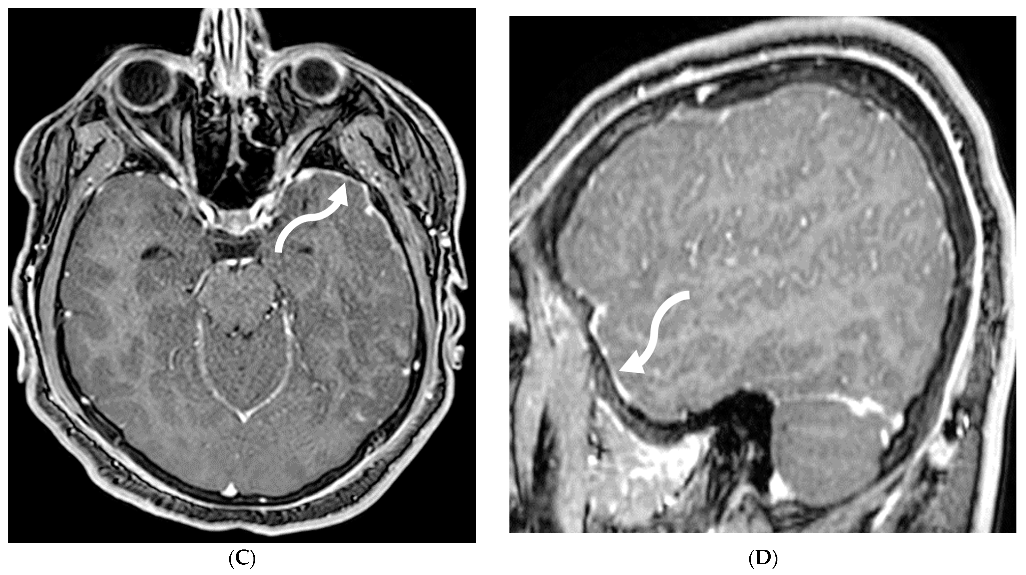 Tomography 10 00143 g023b Tomography 10 00143 g023b