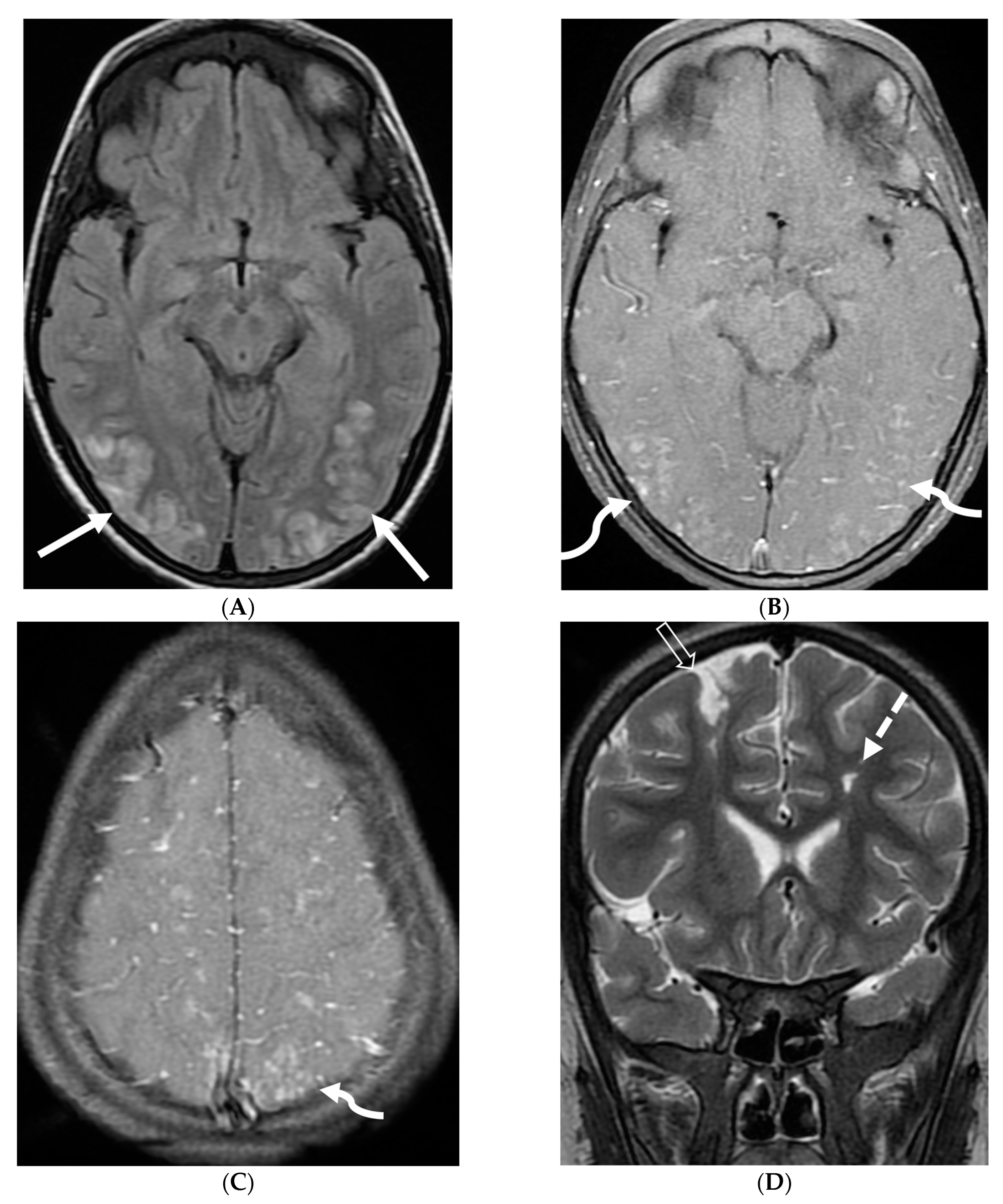 Tomography 10 00143 g024 Tomography 10 00143 g024