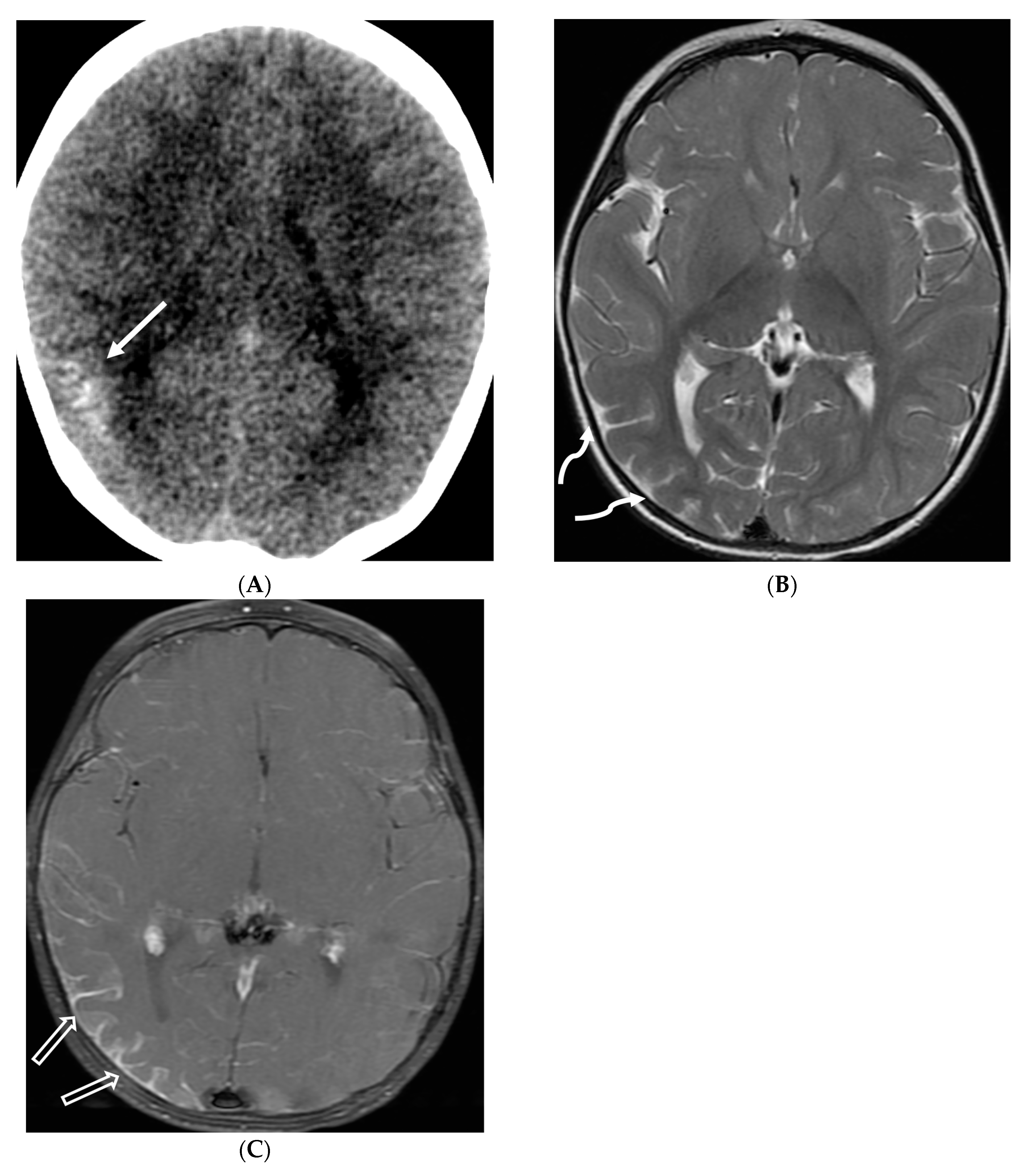 Tomography 10 00143 g025 Tomography 10 00143 g025