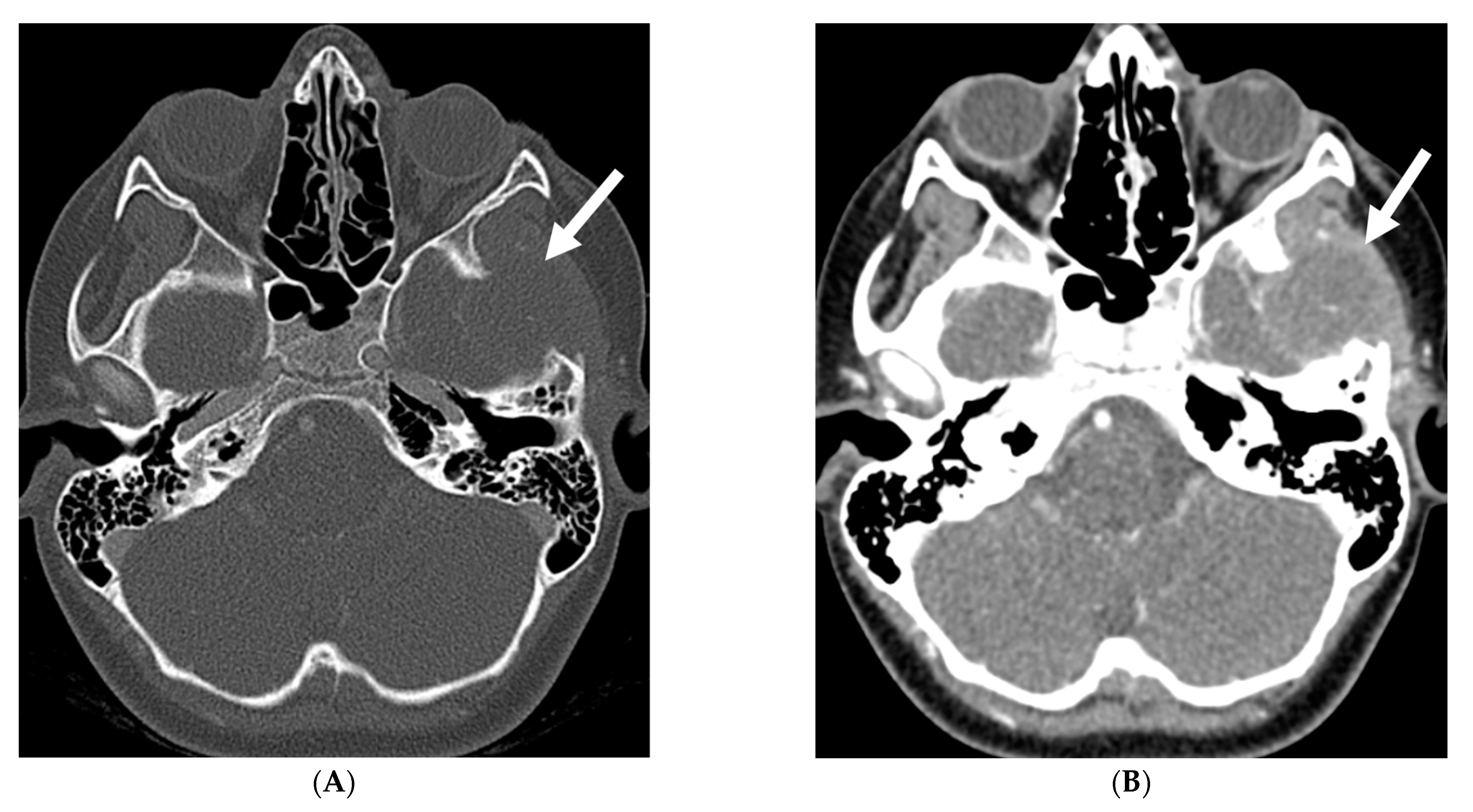 Tomography 10 00143 g026a Tomography 10 00143 g026a