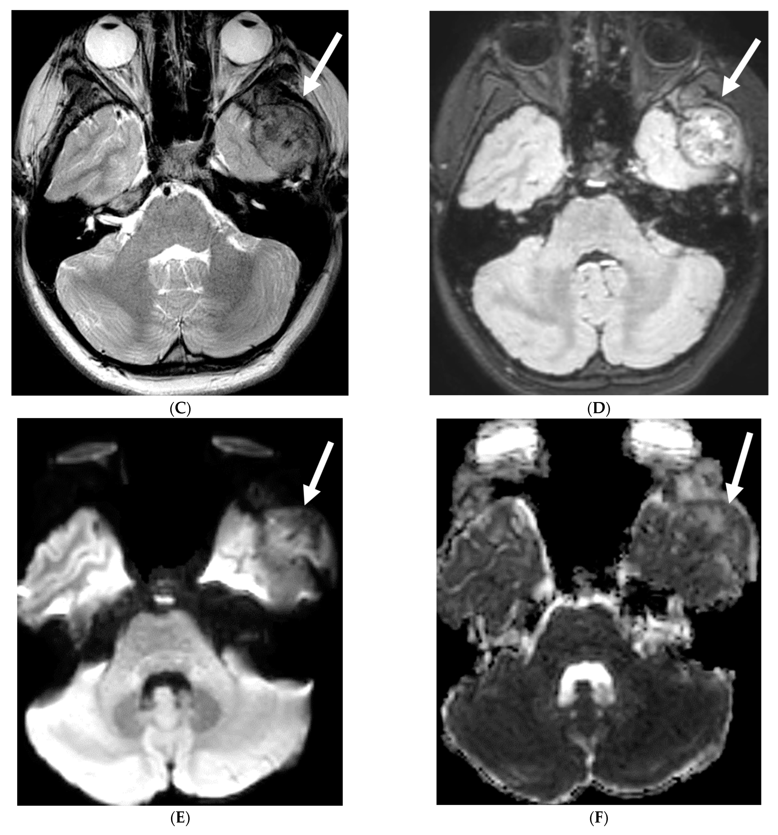 Tomography 10 00143 g026b Tomography 10 00143 g026b