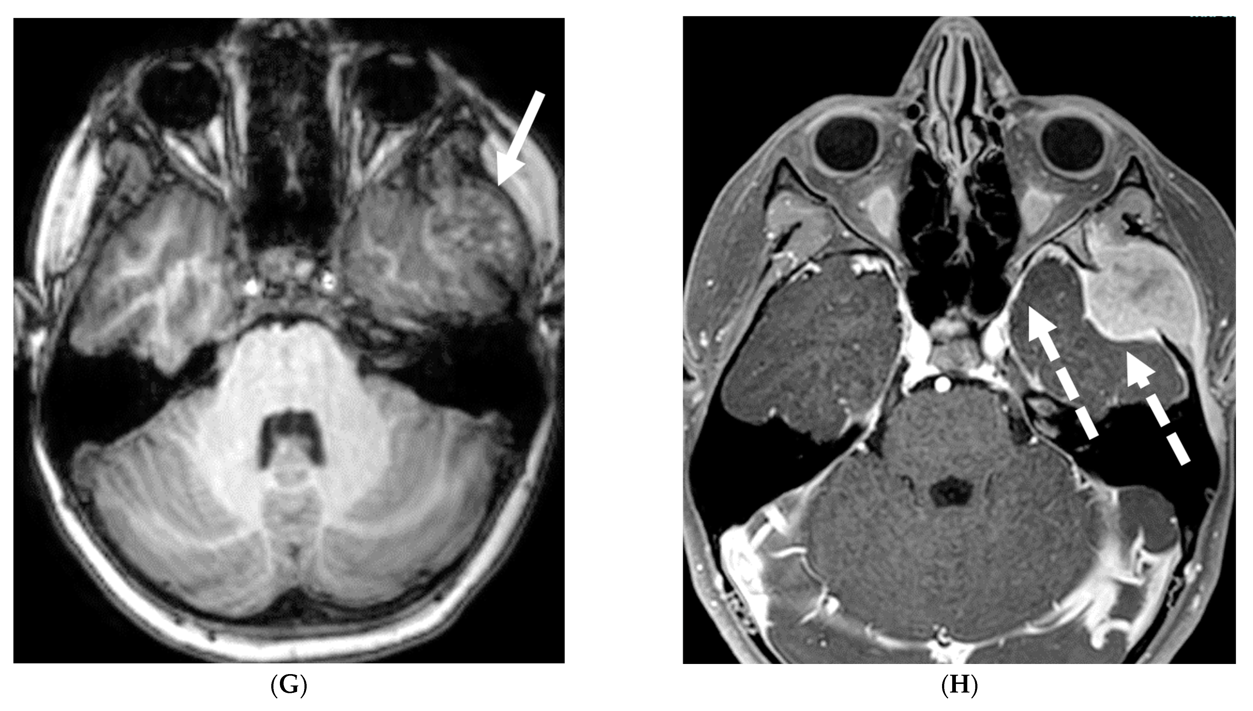 Tomography 10 00143 g026c Tomography 10 00143 g026c