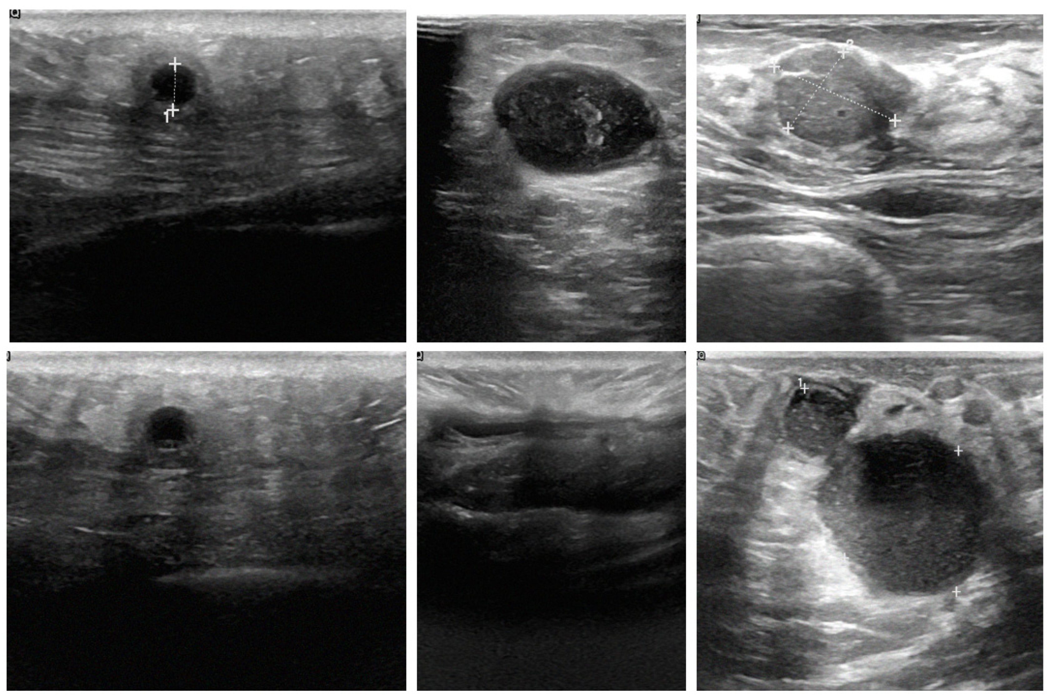 Tomography 10 00145 g010