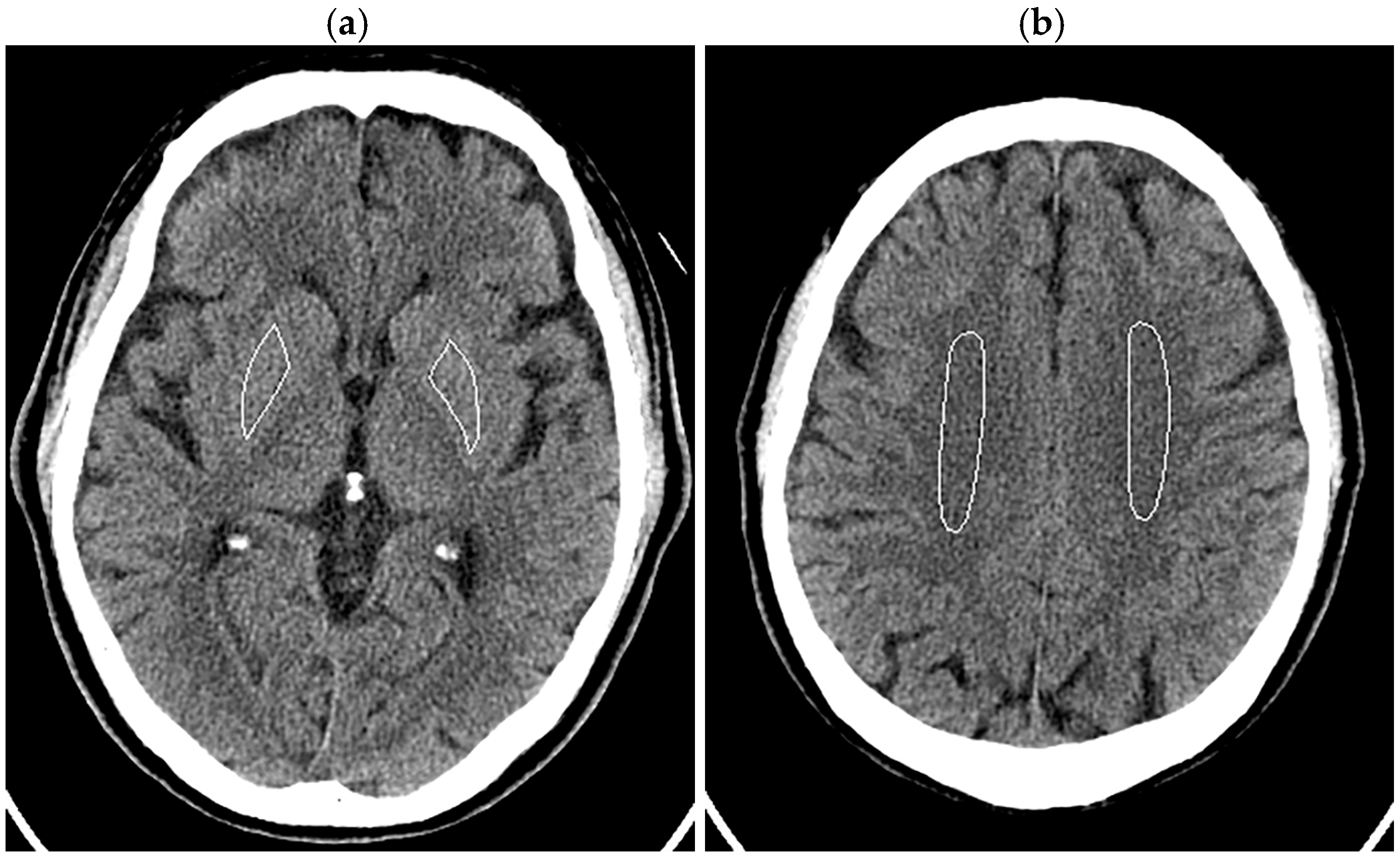 Tomography 10 00147 g002
