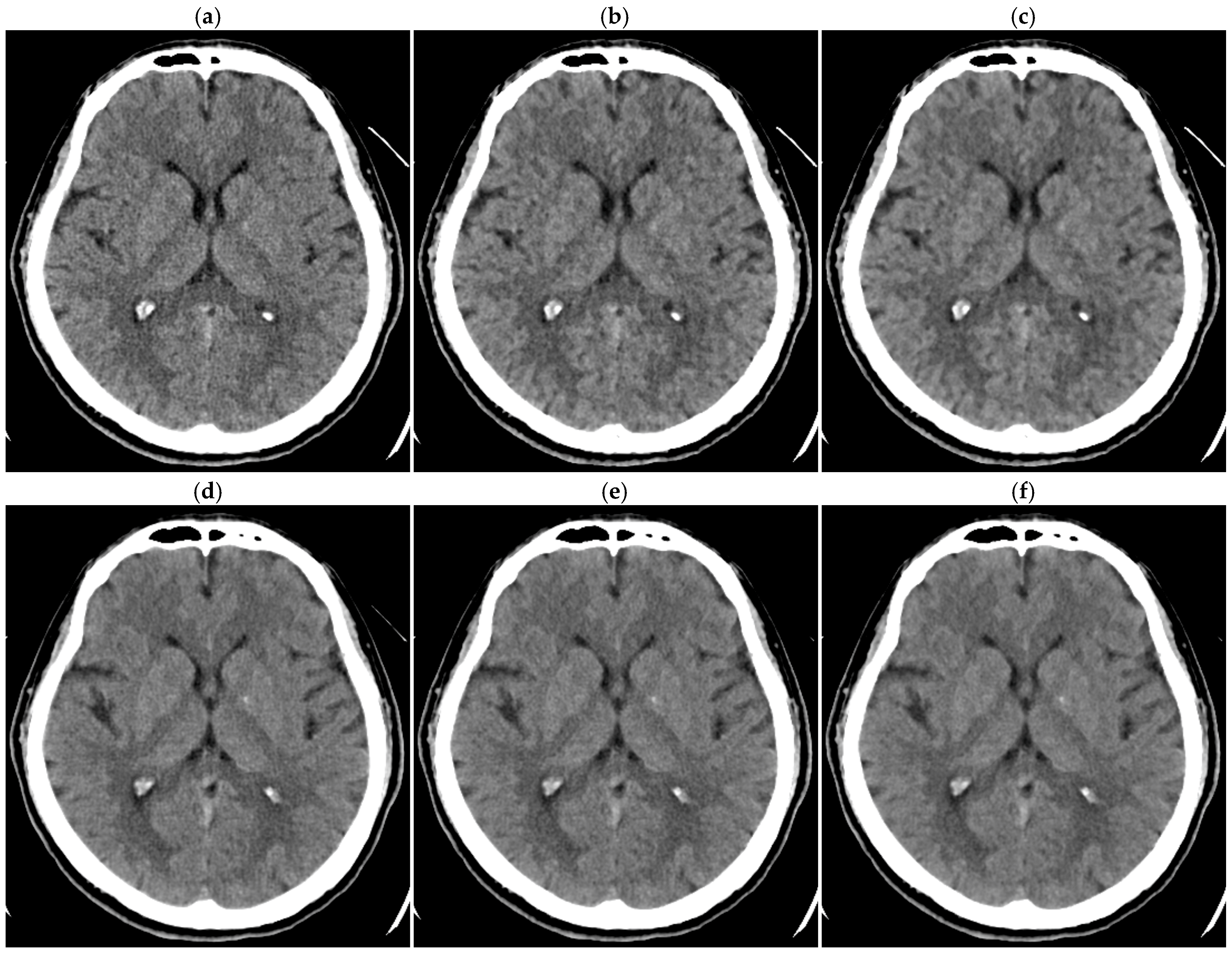 Tomography 10 00147 g006