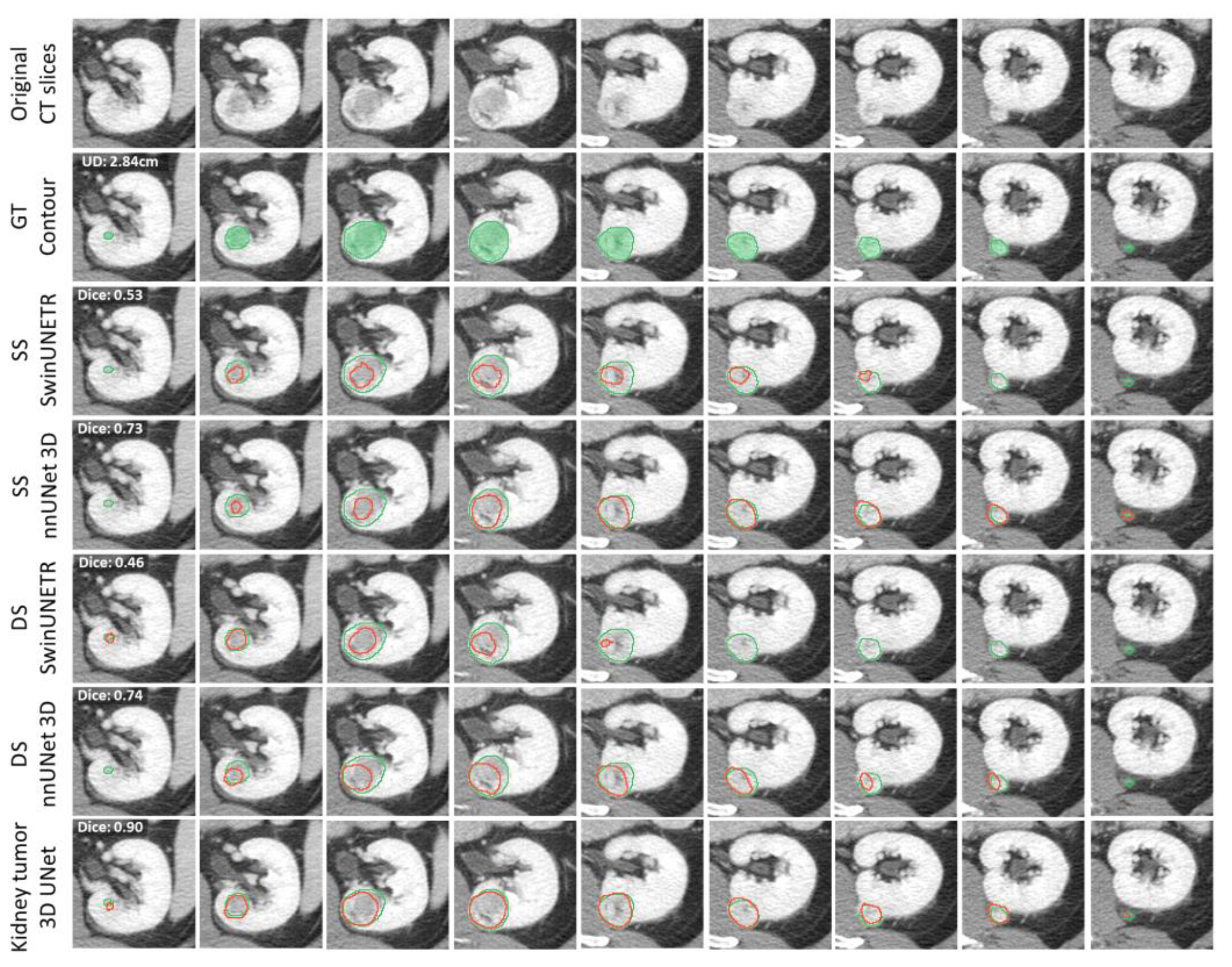 Tomography 11 00003 g004